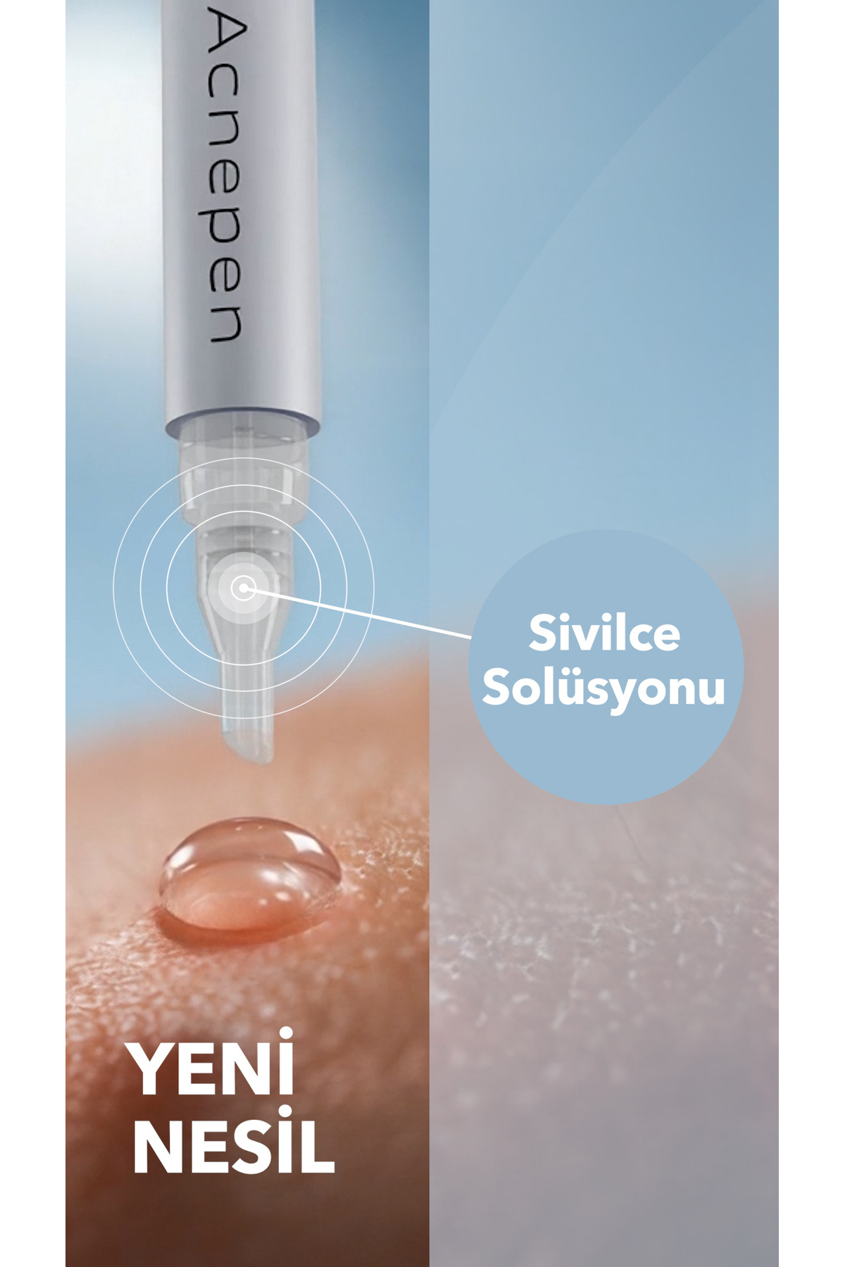 Acnepen Karşıtı Solüsyon - Akne Karşıtı Serum — E010203AC01 — تصویر 4 از 9