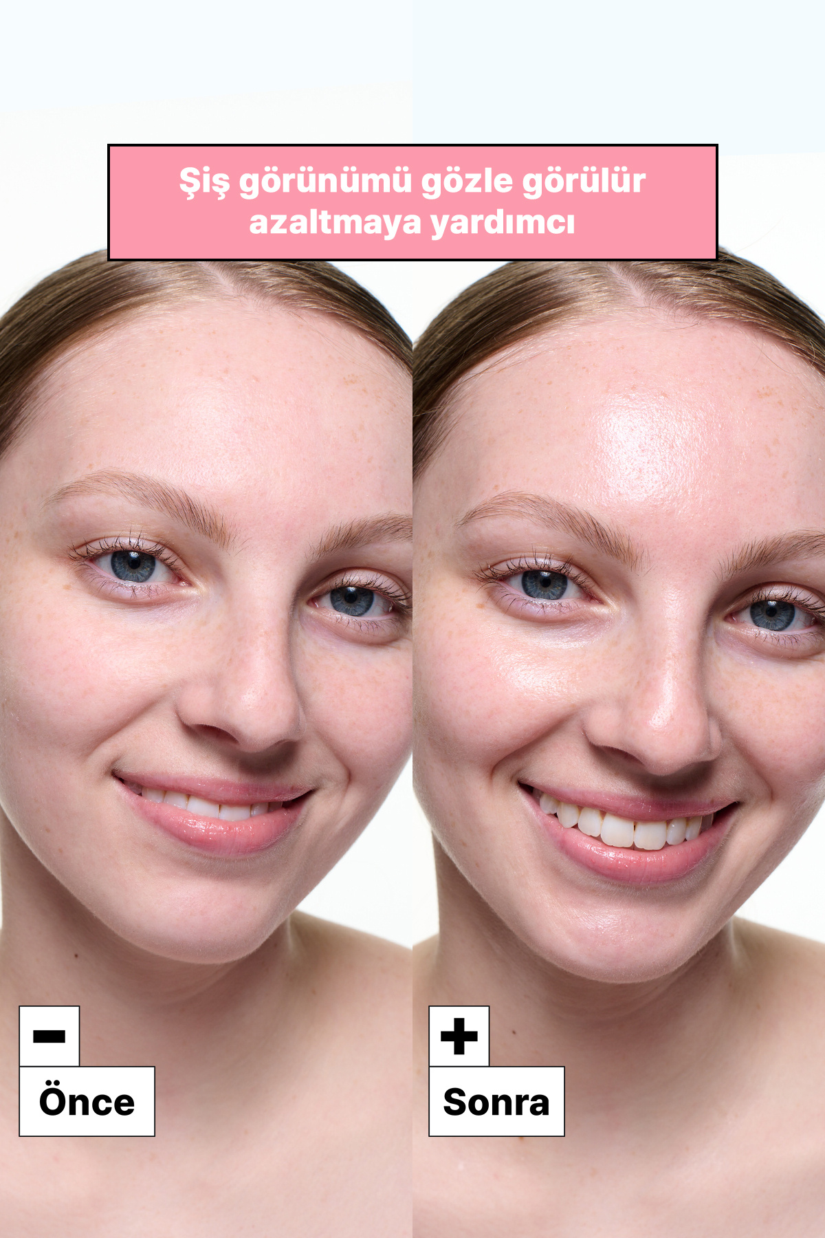 Cryo Sorbet Icy Yüz Maskesi — 145913 — تصویر 6 از 8