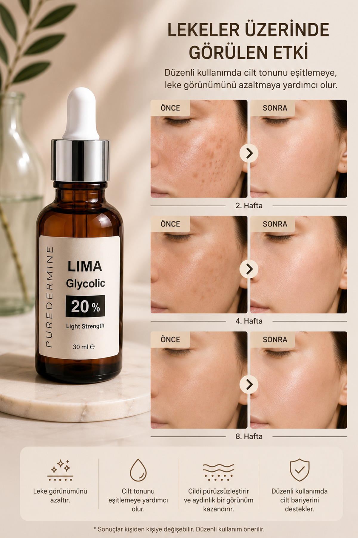 سرم گلیکولیک اسید گلیکولیک 20% لیما | سرم روشن کننده و بازسازی کننده پوست برای کمک به کاهش ظاهر لکه های پس از آکنه — gmqs — تصویر 5 از 8
