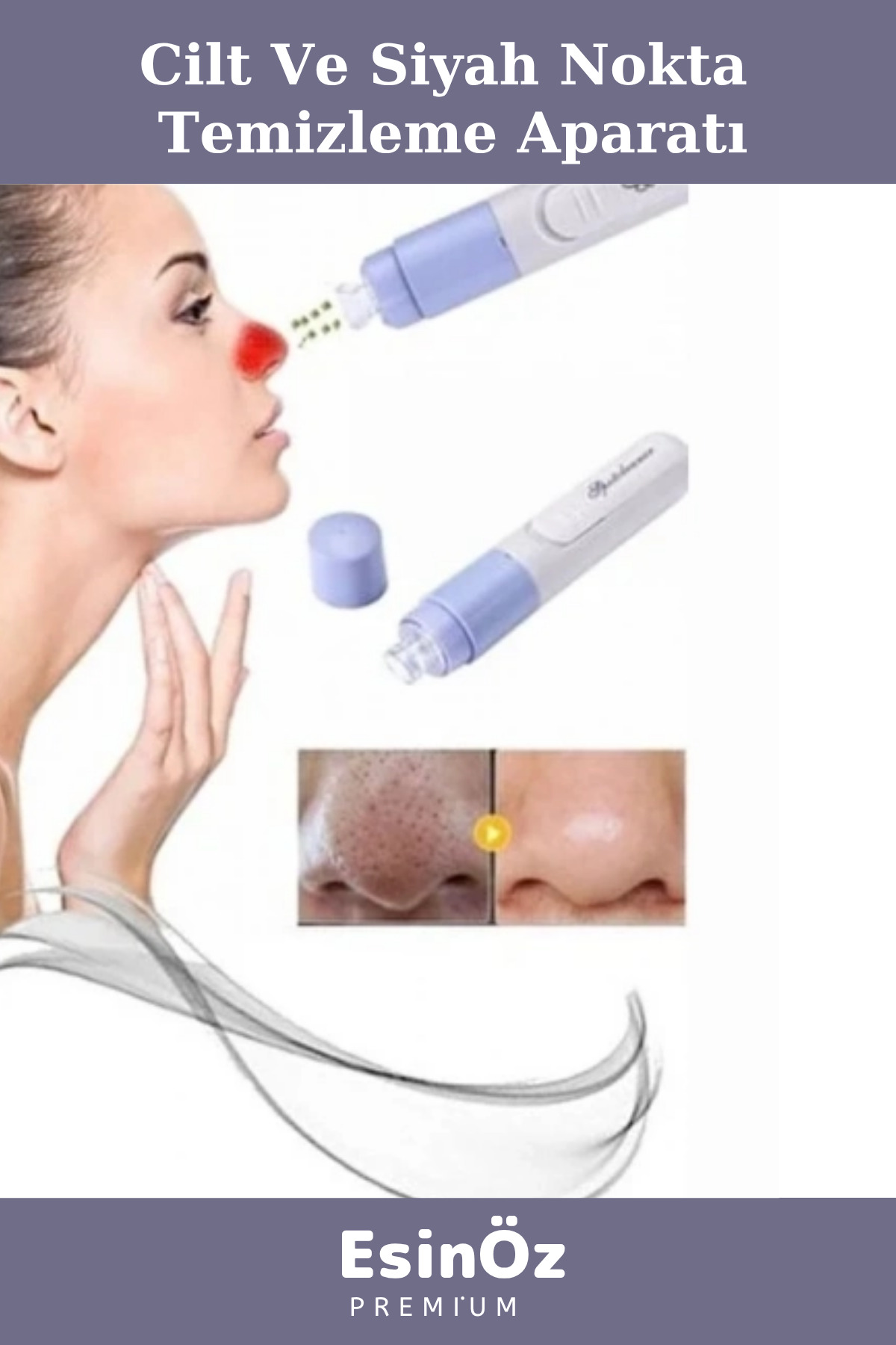 دستگاه #دستگاه_برداشتن_جوش_سریاه جاروبرقی باتری‌دار - EK231 — تصویر 2 از 4