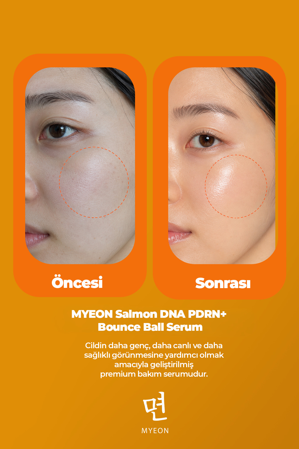 Somon DNA PDRN+ Bounce Ball Serum 30 ml – Çift Fazlı Cilt Gençleştirme & Lifting Etkili Serum — PDRN01 — تصویر 7 از 8