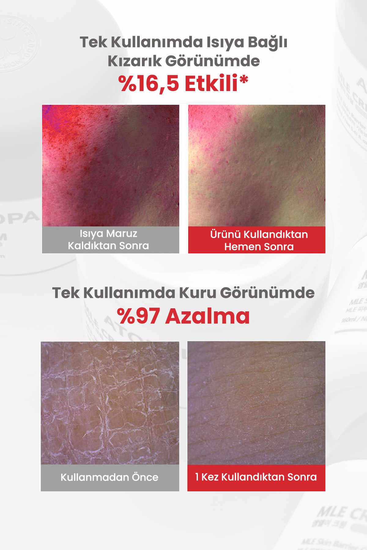 Atopik Ciltlere Özel Cilt Bariyerini Destekleyen Yoğun Nemlendirici Krem MLE Cream 65 ml — ATP01 — تصویر 6 از 9