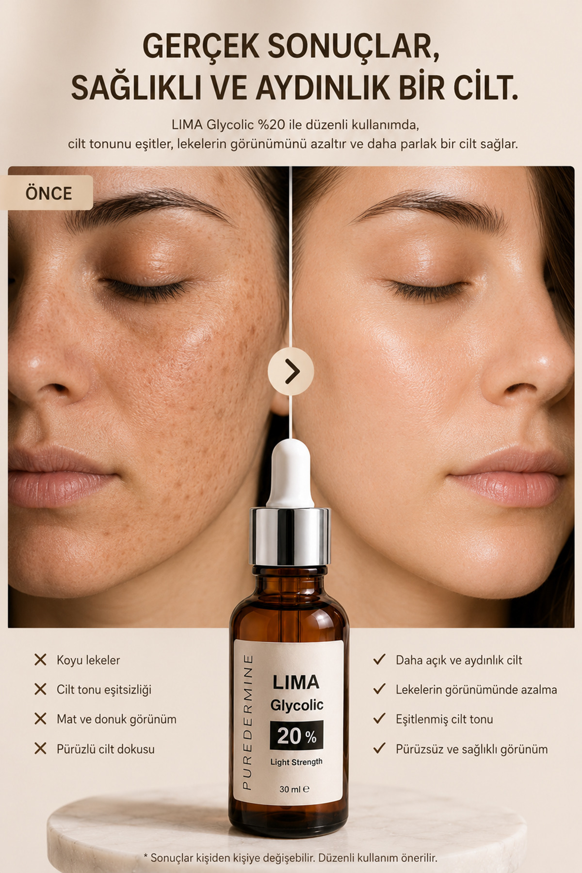 سرم گلیکولیک اسید گلیکولیک 20% لیما | سرم روشن کننده و بازسازی کننده پوست برای کمک به کاهش ظاهر لکه های پس از آکنه — gmqs — تصویر 2 از 8