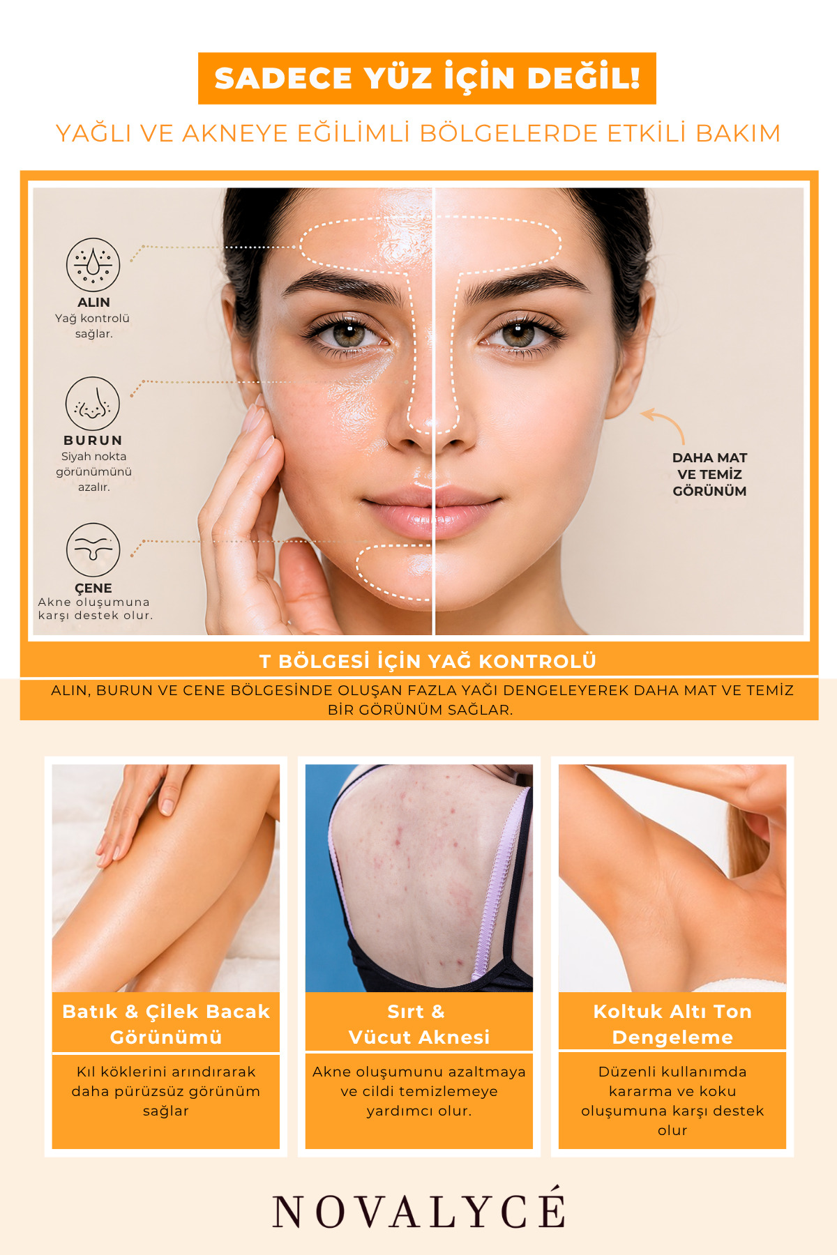 Salisilik Asit Tonik 200 ml | Siyah Nokta Görünümü Karşıtı, Yağlı Ciltlere Özel — NovalyceSalicylicAcidToner — تصویر 3 از 4