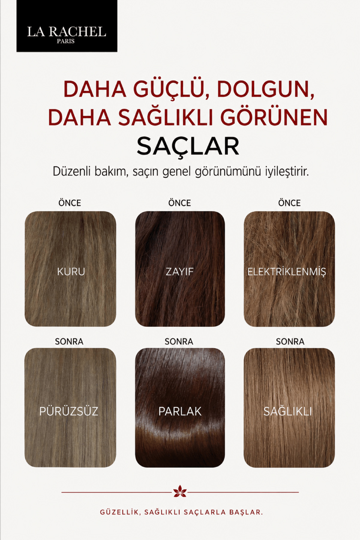 Yavaş Uzayan ve Yıpranmış Saçlar İçin 3’lü Profesyonel Bakım Seti – Daha Güçlü, Daha Dolgun ve Sağlıklı Görünümlü Saçlar — 86839410113533232 — تصویر 4 از 6
