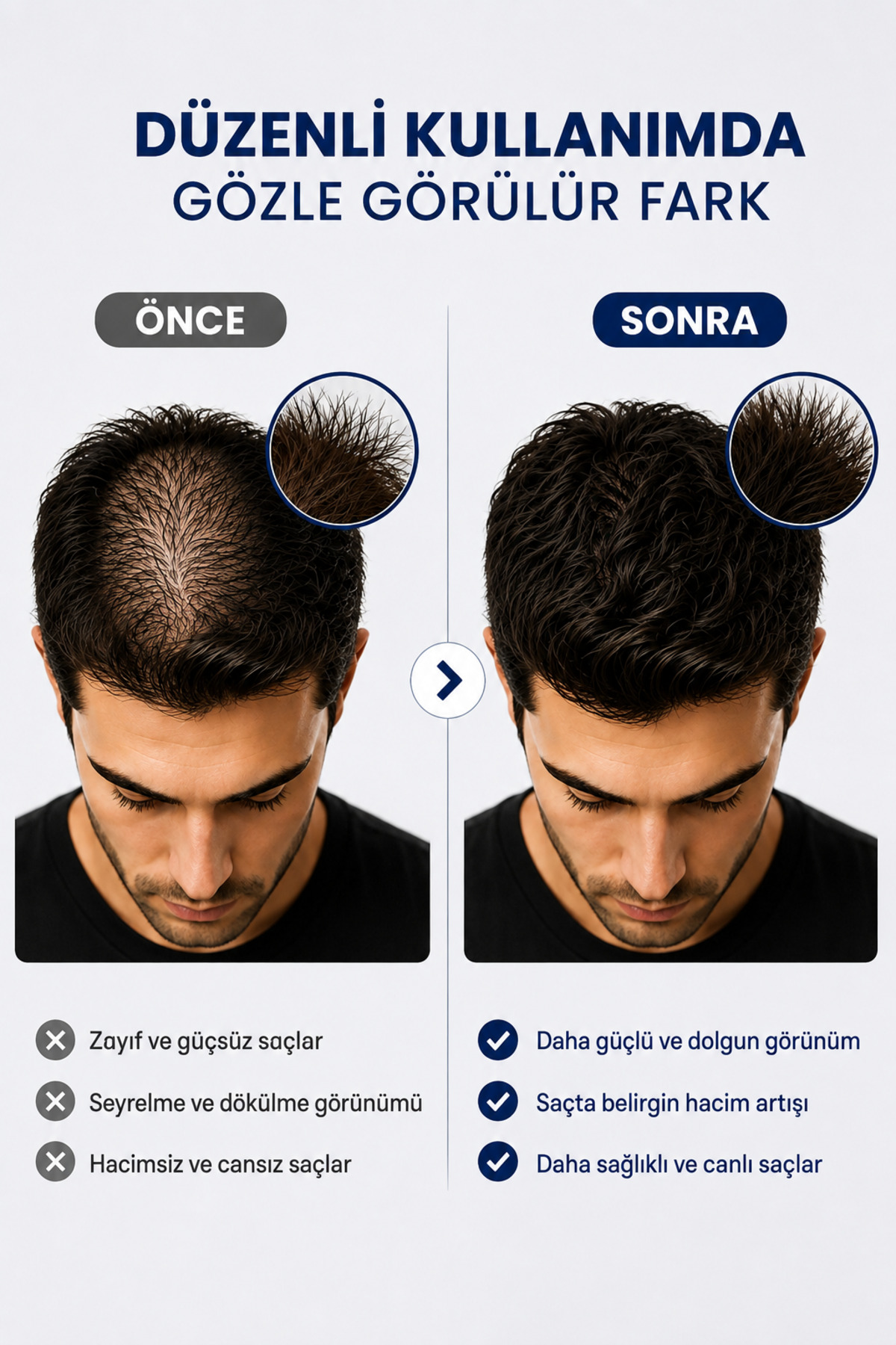 Saç Dökülmesine Karşı Bakım Şampuanı 250 ml – Kolajen, Keratin, Biotin ve Peptit Kompleksi — OPSD2026 — تصویر 7 از 7