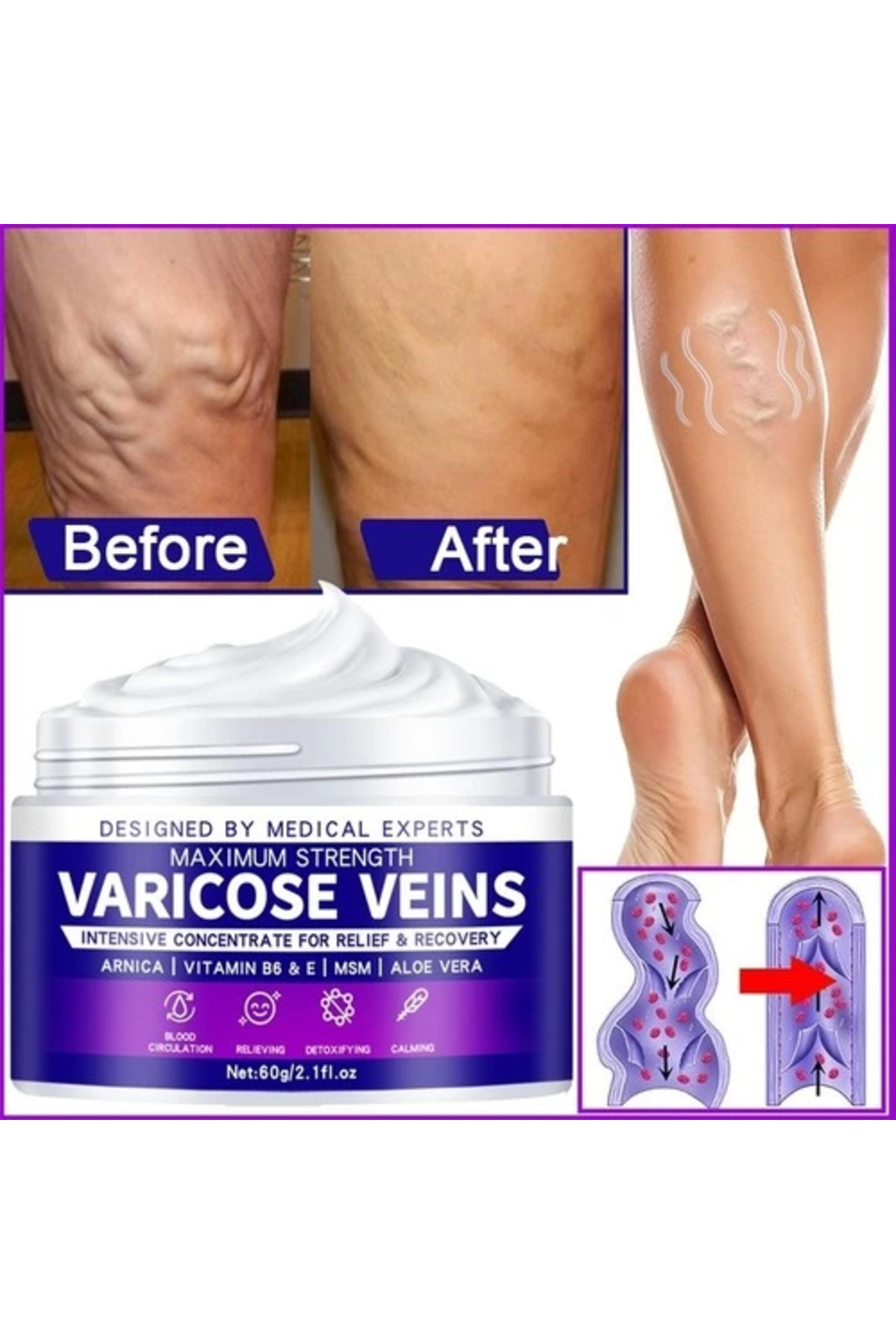 Maximum Strength Varicose Veins Krem 100 ml 1 Adt — DCCBBB-Z772369-AGC01 — تصویر 2 از 2