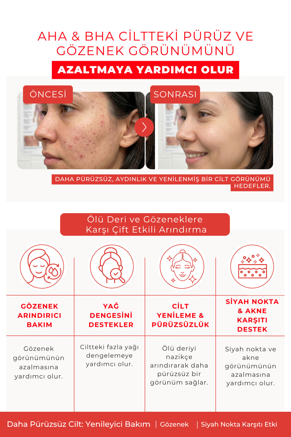 تونر AHA BHA 200 میلی لیتر | ضد جوش سرسیاه، مراقبت از منافذ پوست — NovalyceAhaBhaFacialToner — تصویر 2 از 3