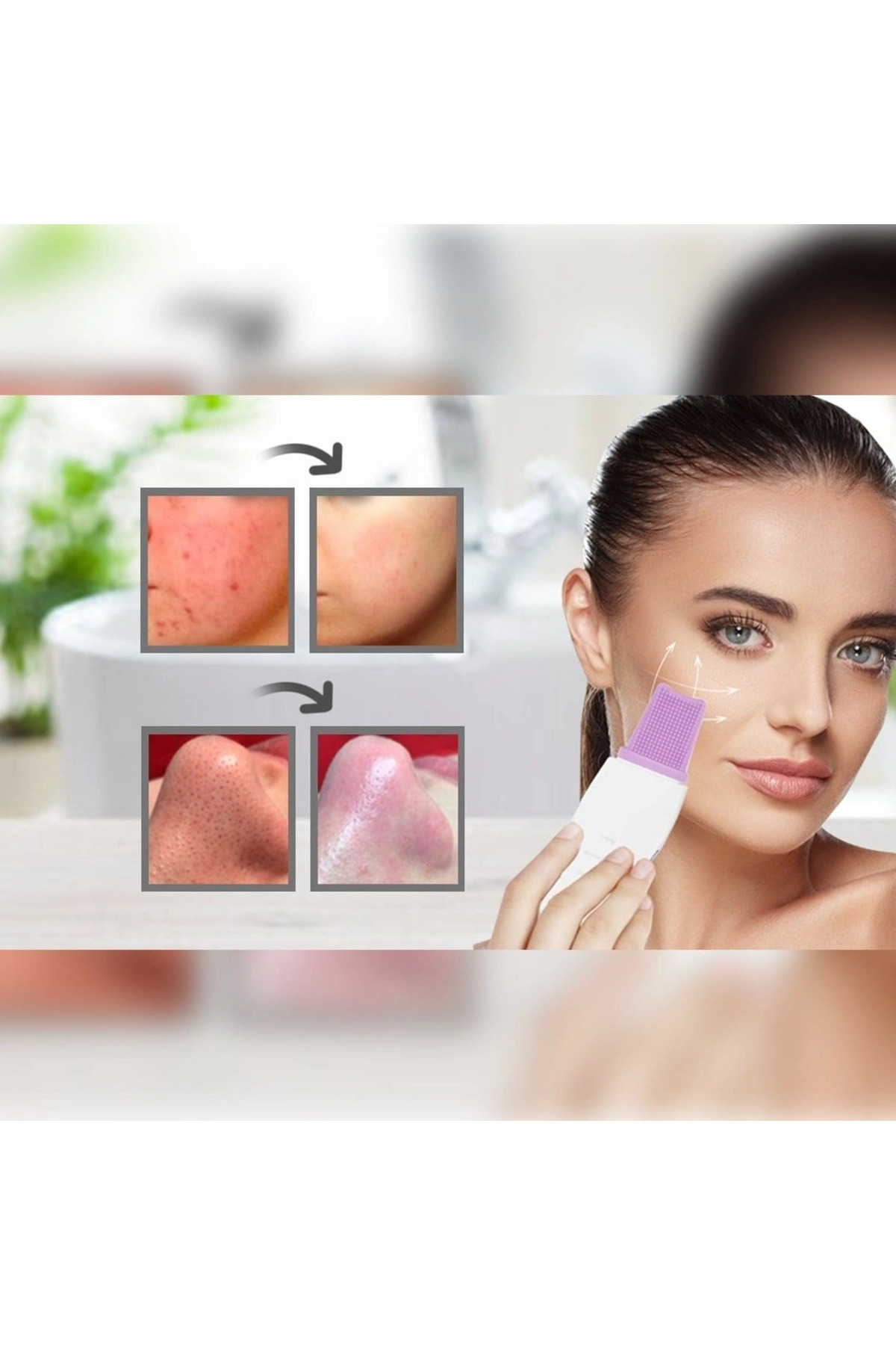 کاردک اولتراسونیک مخصوص جوش‌های سرسیاه و قابل شارژ برای پاک کردن پوست — goitedarik1.AKH0013K-dp-98.22 — تصویر 3 از 3