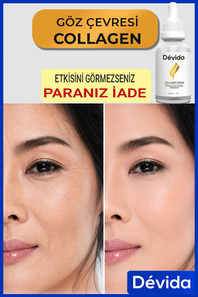 Devida Kırışıklık Karşıtı Serum Botox Etkili Göz Çevresi ve Kaz Ayağı İçin Ko...