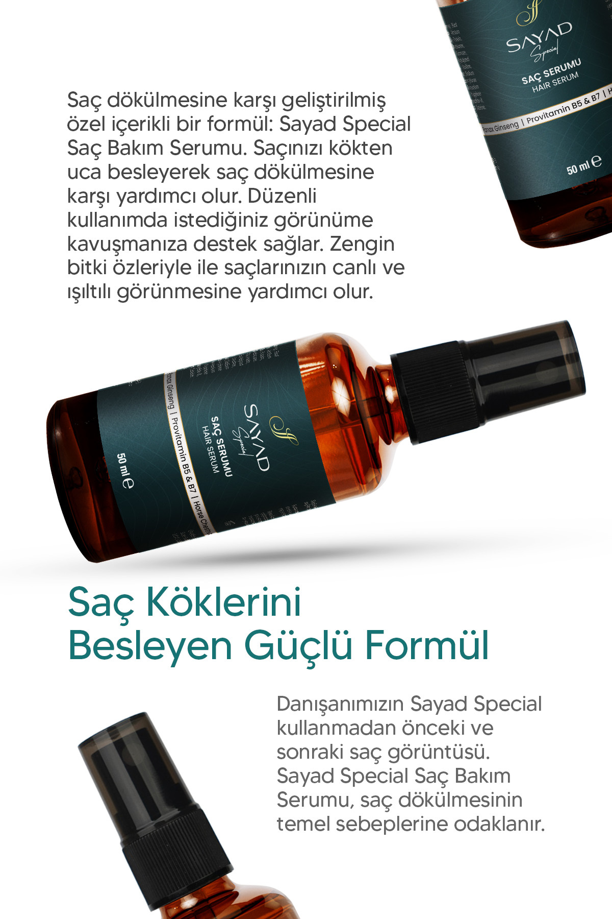 Special Dökülme Karşıtı ve Güçlendirici Saç Serumu — 8684198996219 — تصویر 4 از 6