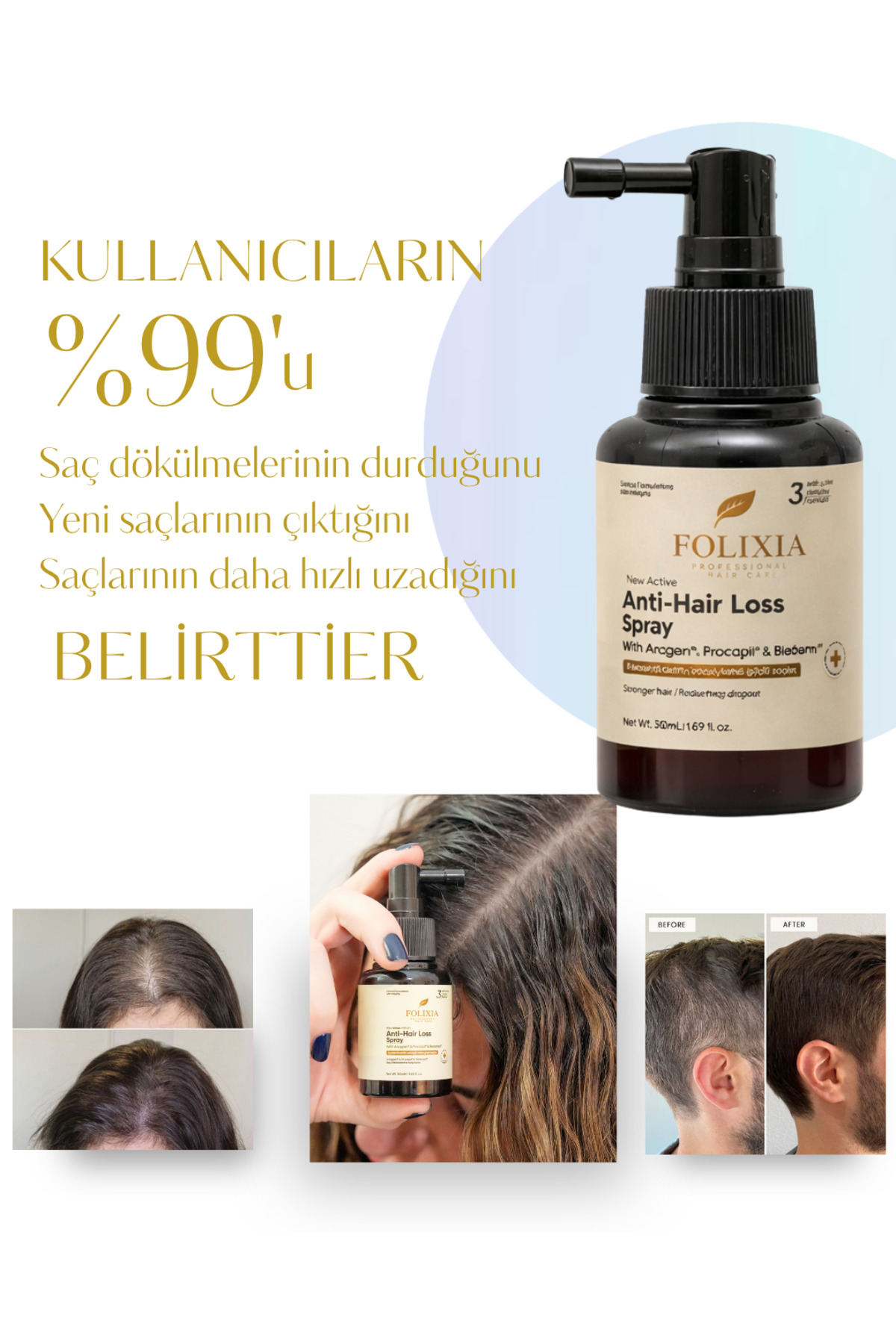 Saç Spreyi – Dökülmeye Karşı Yoğun Bakım (Redensyl + Procapil + Anagain) — 1 — تصویر 2 از 5