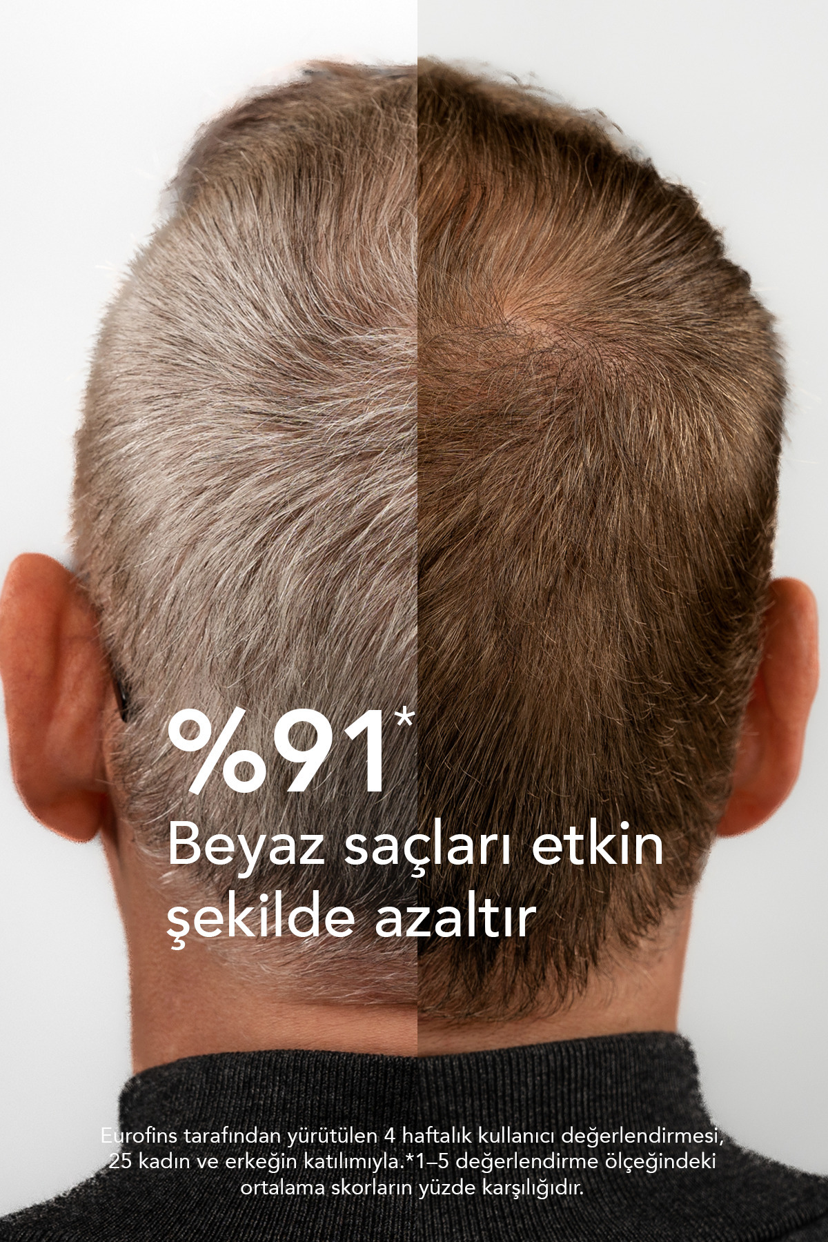 Gr-7 Beyaz Saçlara Doğal Çözüm Sunan Beyaz Saçlar Için Saç Losyonu 125 ml — GR7ANTIGREY — تصویر 3 از 8