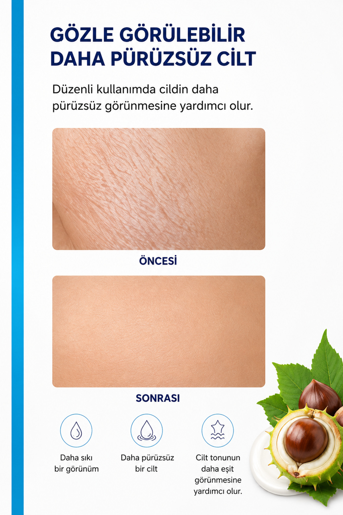 Çatlak Önleyici Cilt Bakım Kremi ( Hamilelik-Sporcu Çatlakları-Hızlı Kilo Alıp Verme ) 200 ML — ÇK25122 — تصویر 6 از 9