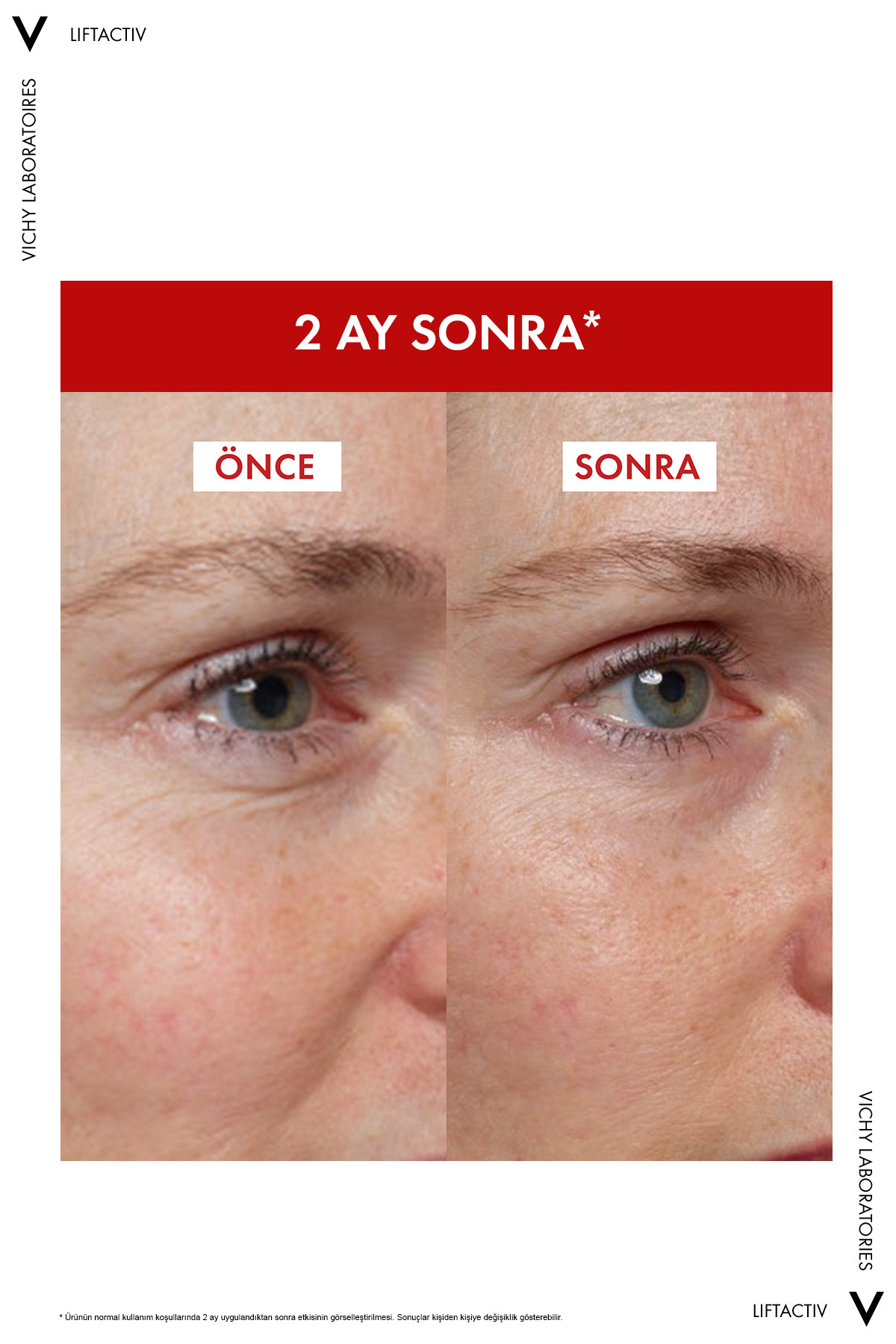 Tüm Cilt Tipleri İçin Kırışıklık Karşıtı Bakım Seti: Collagen 16 Bonding Serum 30ml&Güneş Kremi 15ml — 8602853651976 — تصویر 5 از 8