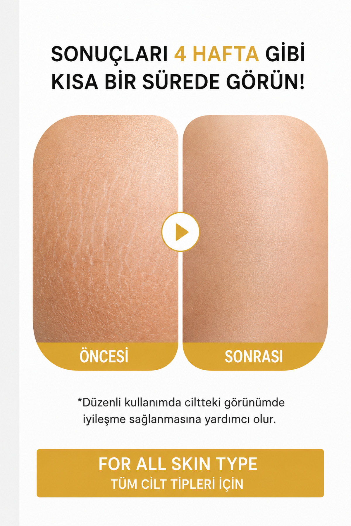 Çatlak Önleyici Cilt Bakım Yağı ( Hamilelik-Sporcu Çatlakları-Hızlı Kilo Alıp Verme ) 150 ML — ÇK25107 — تصویر 6 از 9