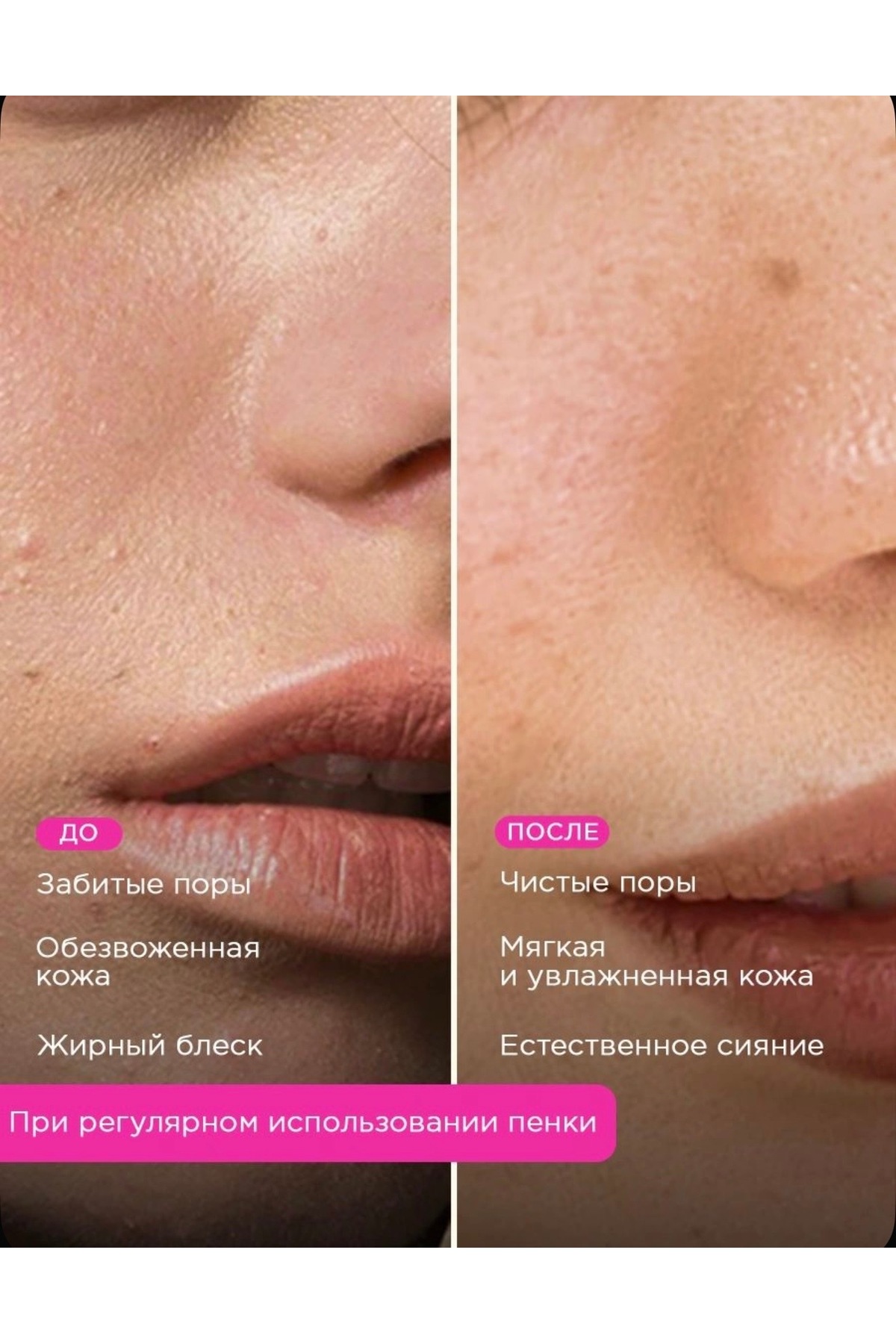 🧴 Facial Foam Yüz Temizleme Köpüğü 150 ml Panthenol & Niacinamide | Nazik Temizlik & Yoğun Nem — vois jel — تصویر 2 از 2