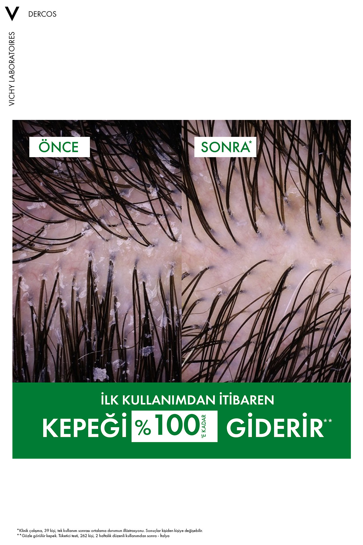 Dercos Kuru Saçlar İçin Kepek Karşıtı Saç Bakım Şampuanı 200 ml — 3337871330262 — تصویر 5 از 9