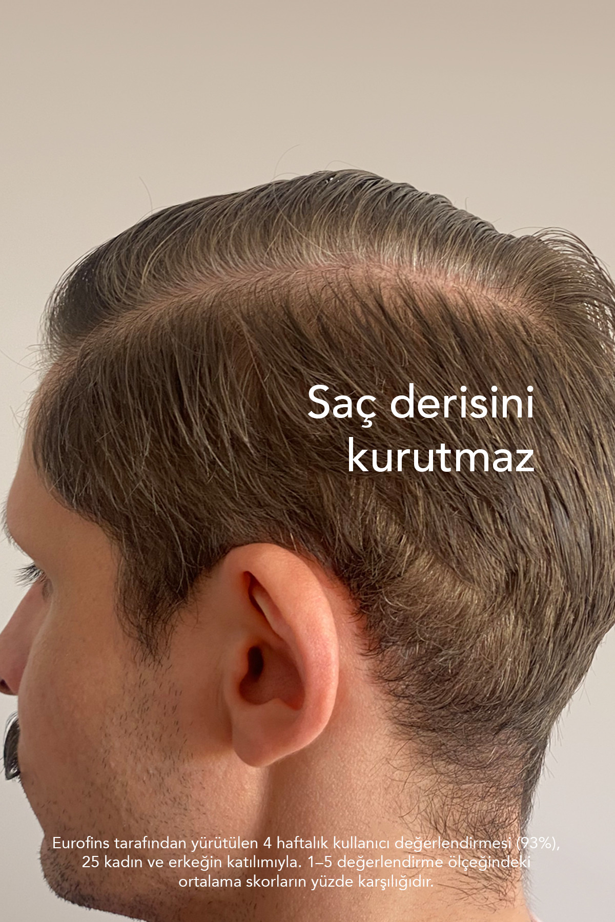 Gr-7 Beyaz Saçlara Doğal Çözüm Sunan Beyaz Saçlar Için Saç Losyonu 125 ml — GR7ANTIGREY — تصویر 6 از 8