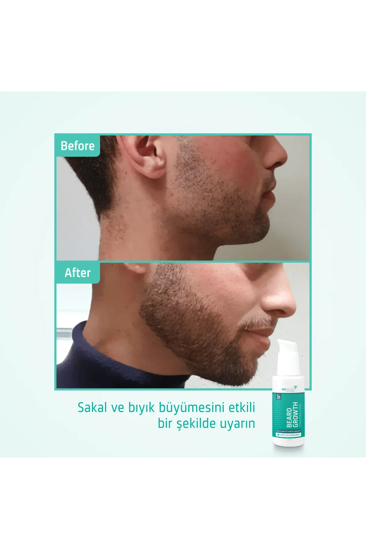 Beard Growth Stimulating Serum — NC060040 — تصویر 5 از 8