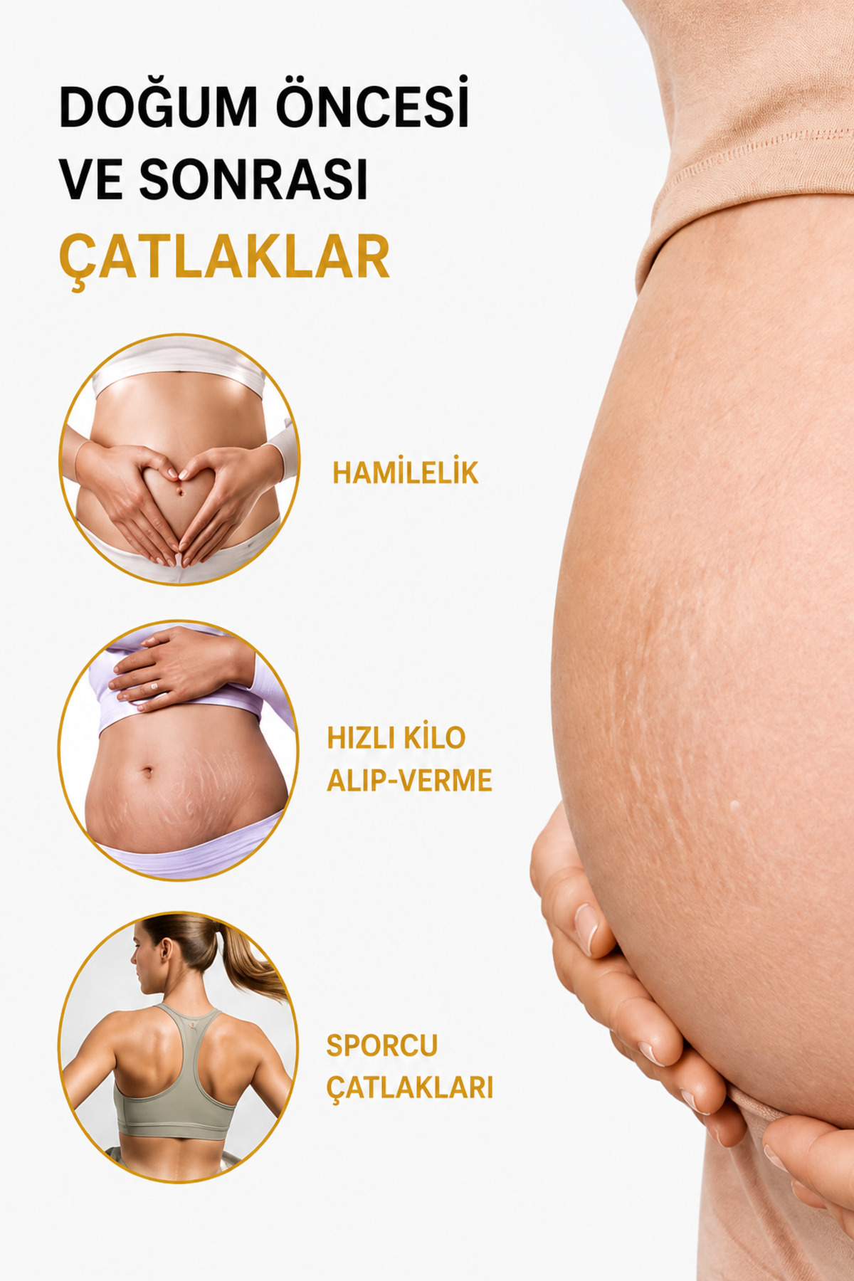 Çatlak Önleyici Cilt Bakım Yağı ( Hamilelik-Sporcu Çatlakları-Hızlı Kilo Alıp Verme ) 150 ML — ÇK25107 — تصویر 4 از 9