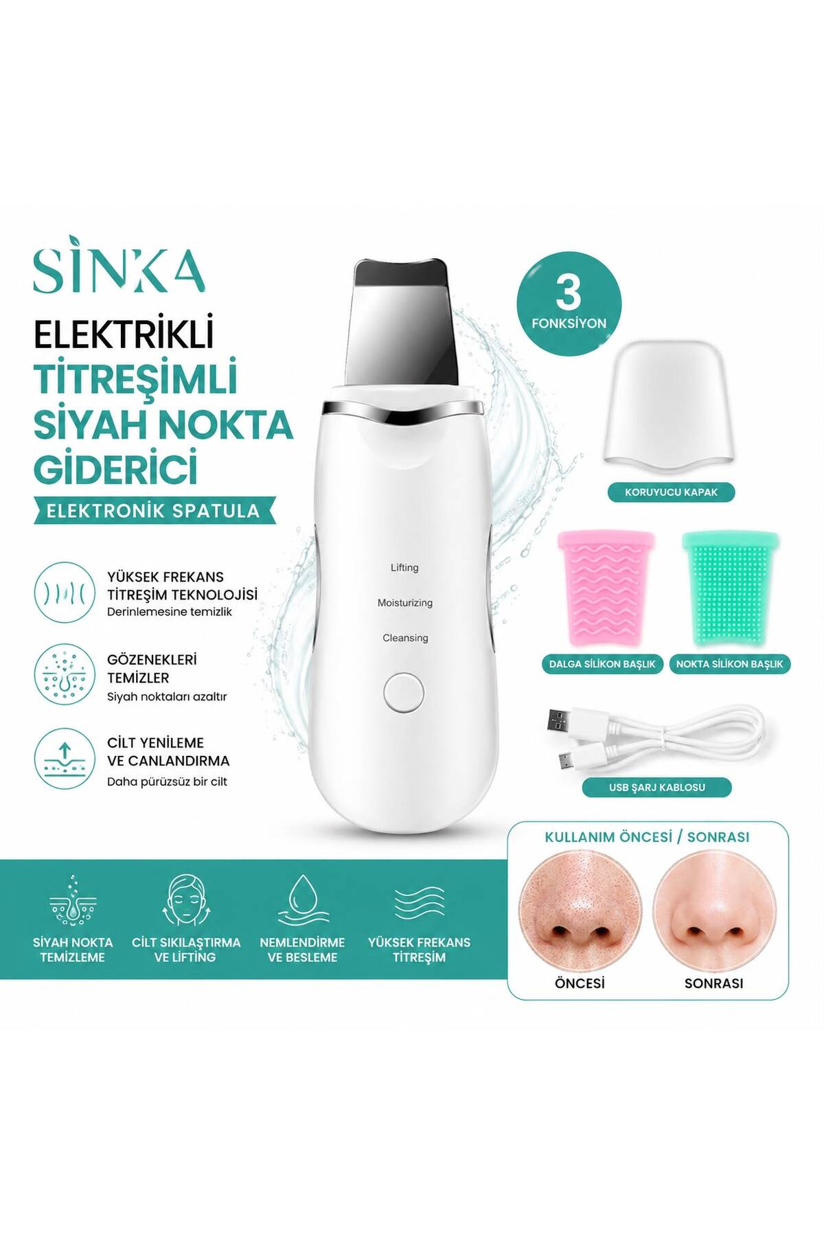 SİNKA Ultrasonik Yüz Elektronic Spatula Siyah Nokta Akne Temizleme Cihazı — سفید 1SİNKA-sptula