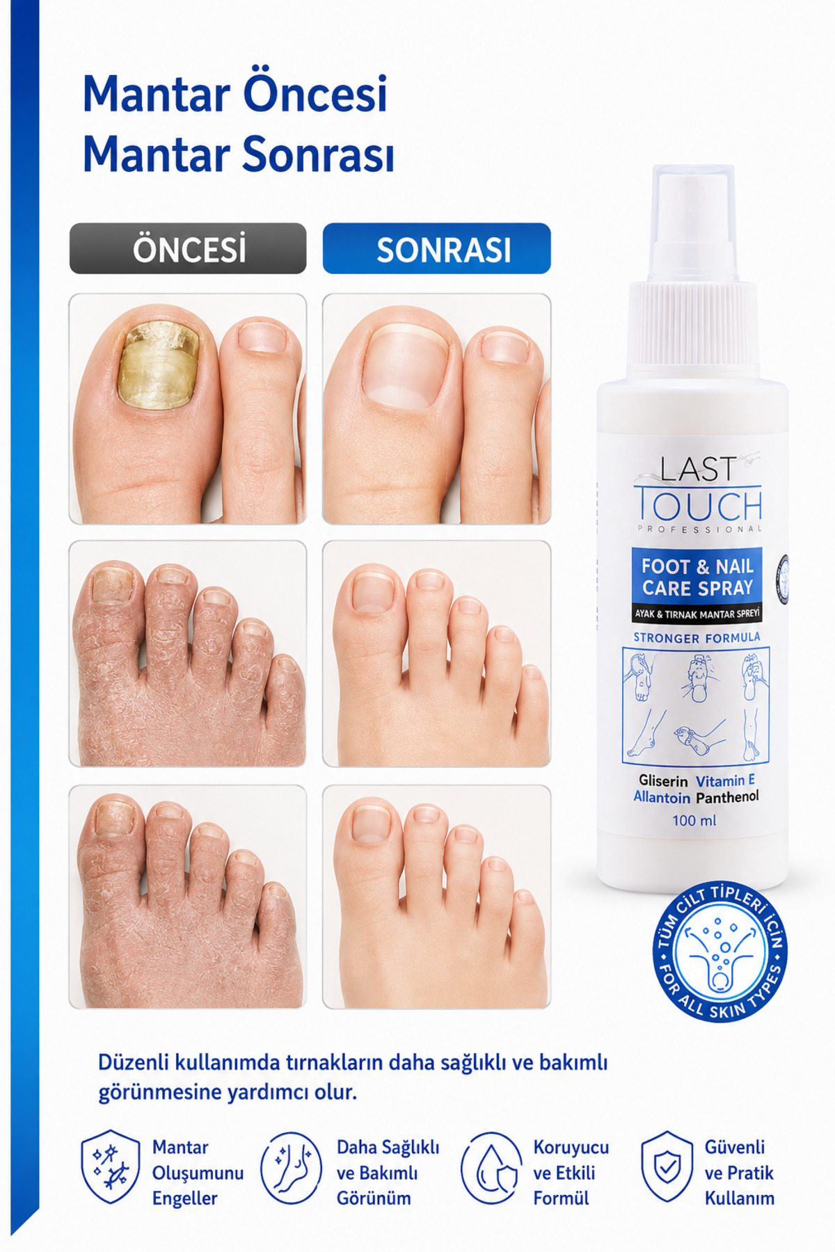 Ayak Ve Tırnak Mantar Spreyi, Kaşıntı, Koku Giderici Ve Nemlendirici 100 Ml (2'li Paket) — ABS2589 — تصویر 5 از 9
