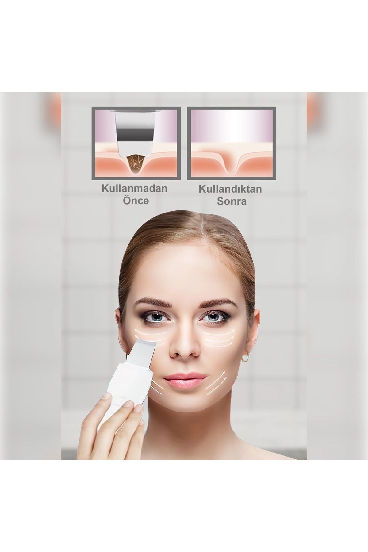Ultrasonıc Siyah Nokta Akne Spatula Şarjlı Cilt Temizleyici — TA-AKH0013K-dp-98 — تصویر 2 از 3