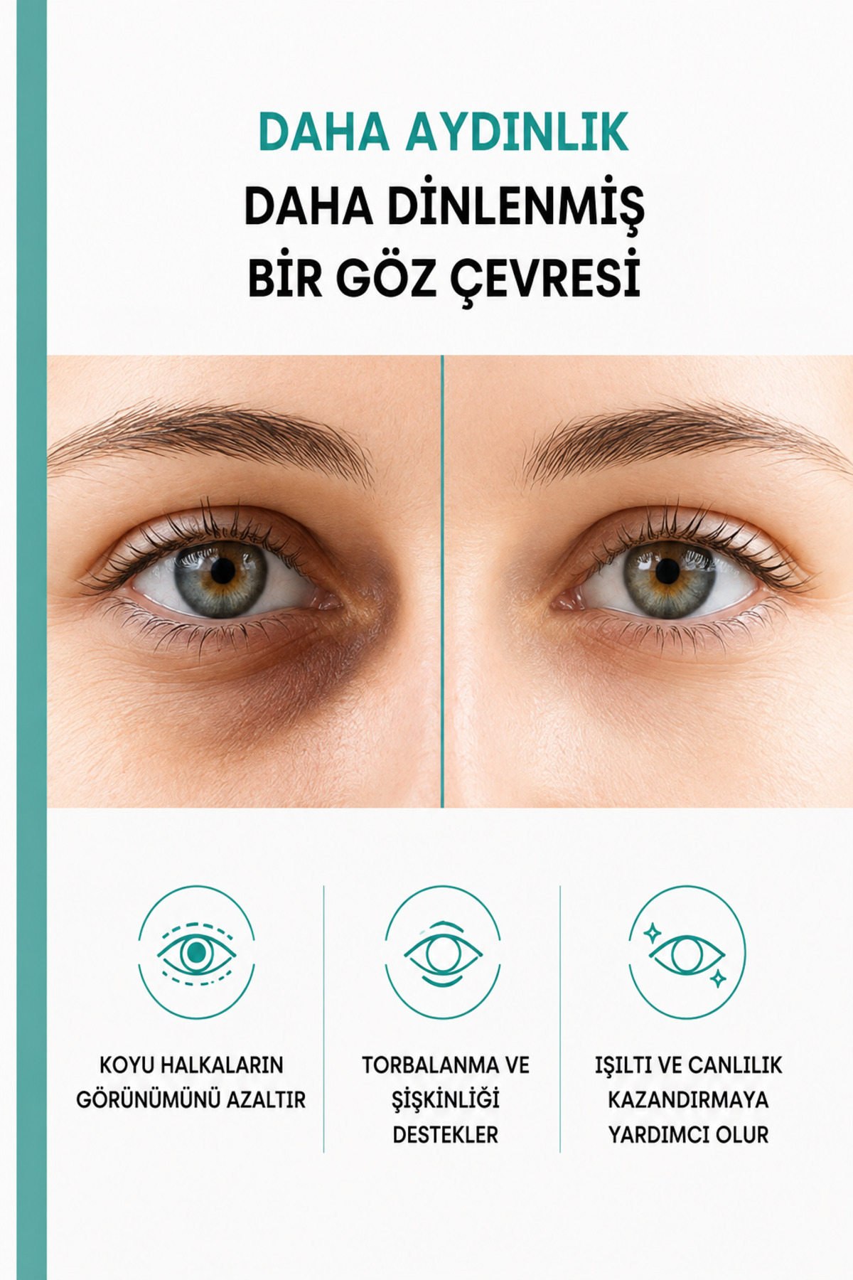 2'li Paket Göz Altı Morluk Karşıtı Göz Çevresi Serum & Ölü Deriden Arındırıcı Yüz Peeling Jel — TYCD7JM6HN172845647551574 — تصویر 5 از 9