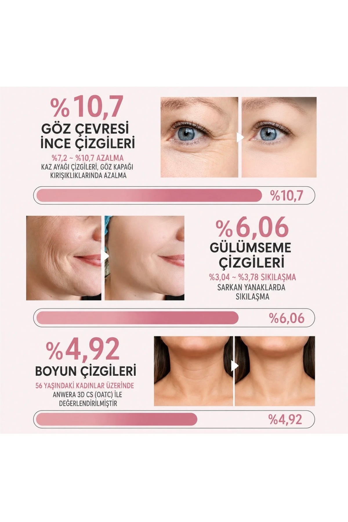 ™Korenlea Botoks Etkili Balm — TYC94A131F0BC9DF984EF4200 — تصویر 5 از 7
