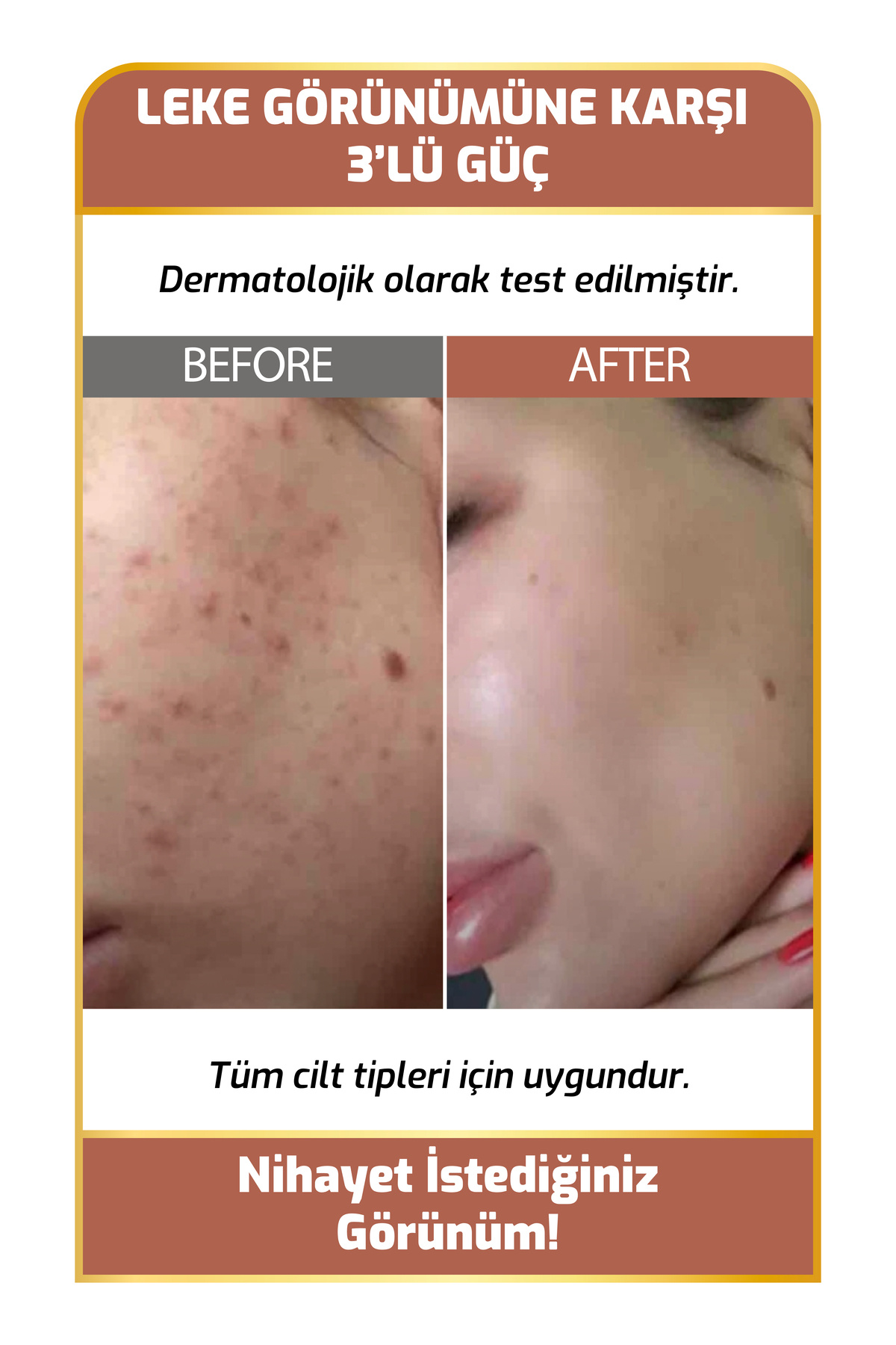 سرم روشن کننده و رفع کننده لک پوست (ویتا-سی و آربوتین) — 8682079030564 — تصویر 5 از 5