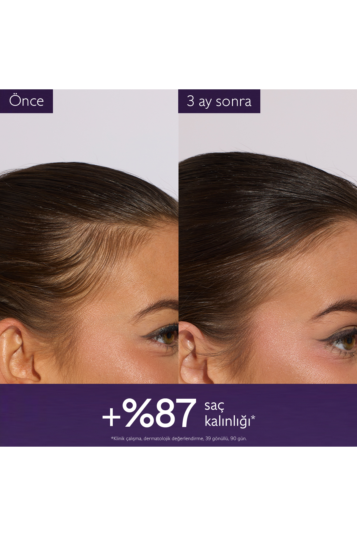 Saç Dökülmesine Karşı Serum 50ml — 581R1 — تصویر 4 از 8