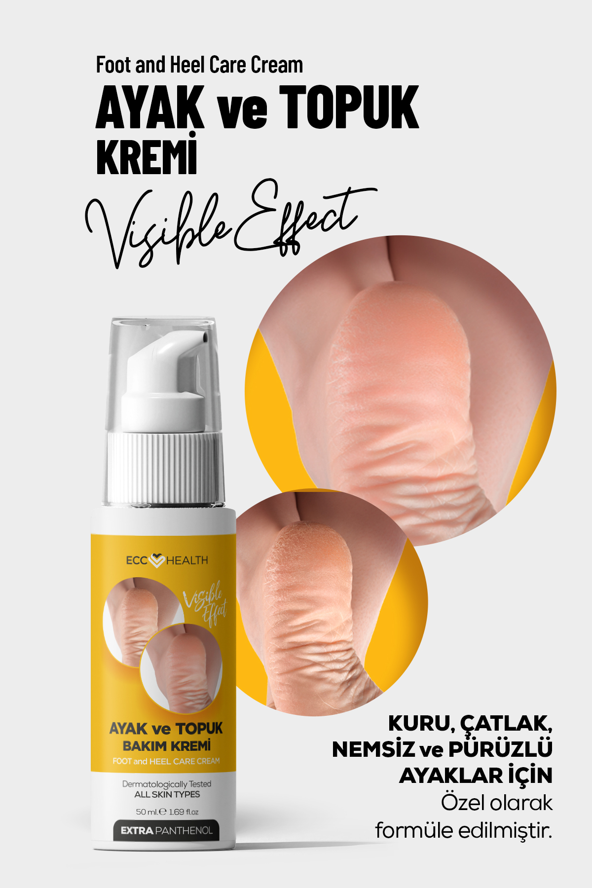 Ecc HEALTH Ayak ve Topuk Çatlak Bakım Kremi 100 ml – Kuru, Sertleşmiş ve Pürüzlü Ayaklar İçin — topukkremi50ml