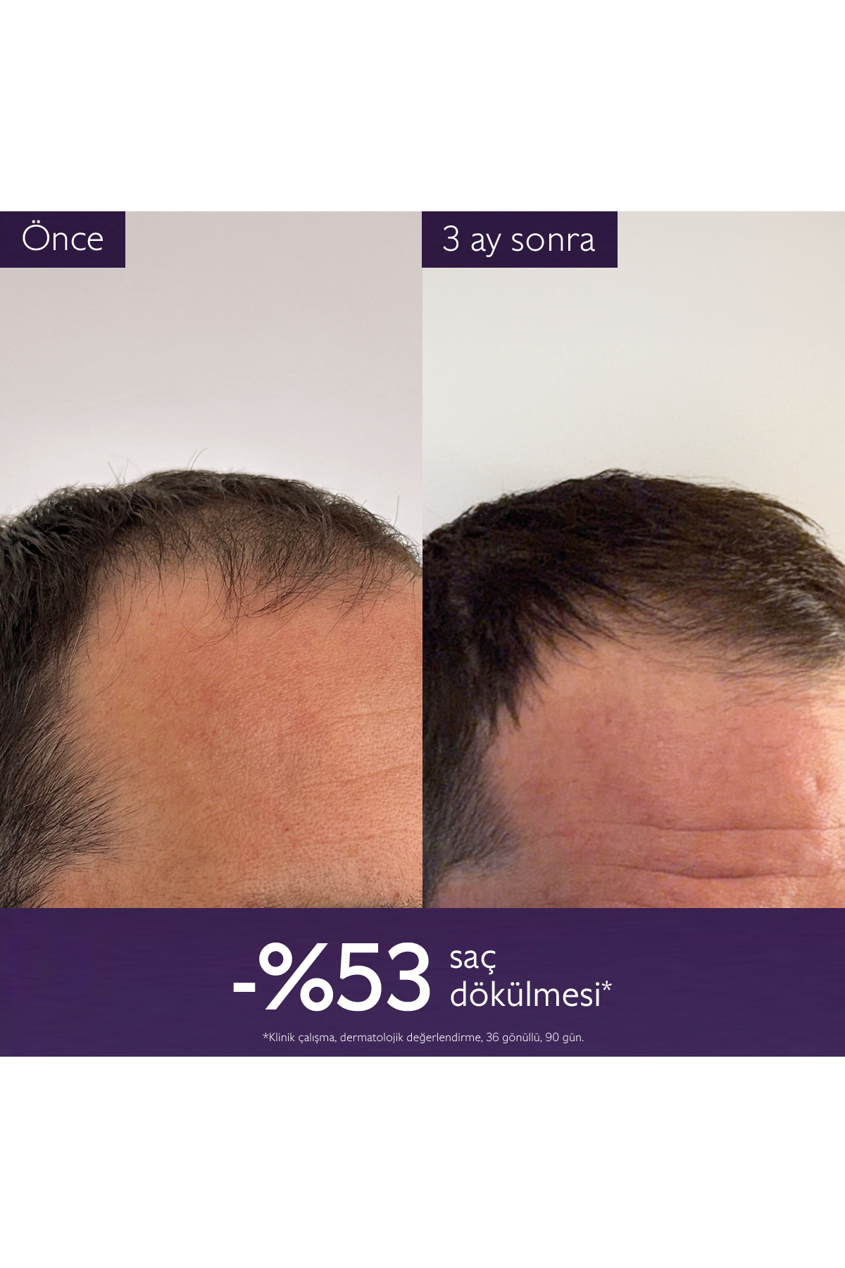 Saç Dökülmesine Karşı Serum 50ml — 581R1 — تصویر 5 از 8