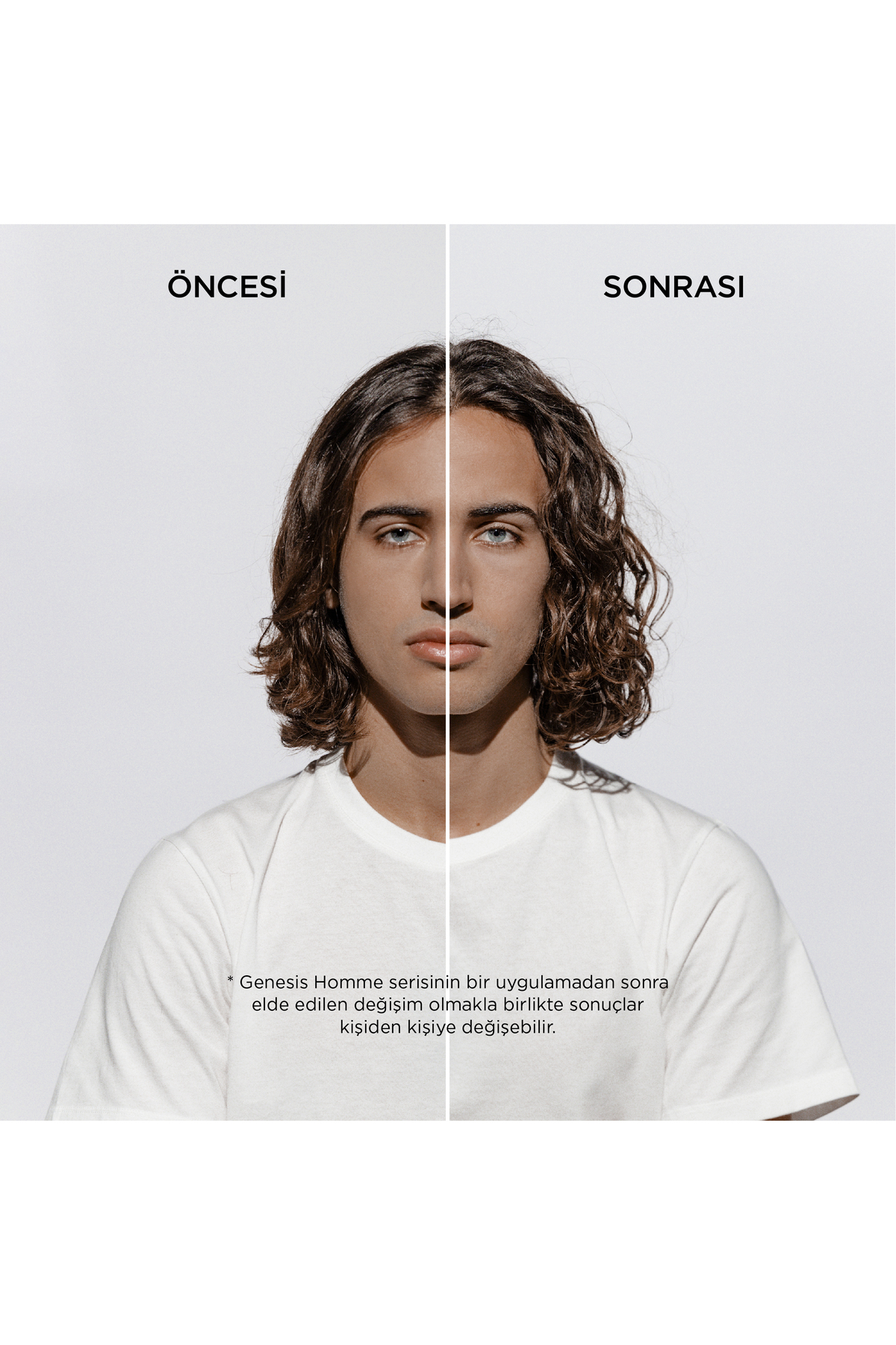 Genesis Homme Erkekler Için Saç Dökülme Karşıtı Güçlendirici Serum 90 ml — 3474637077495 — تصویر 4 از 8
