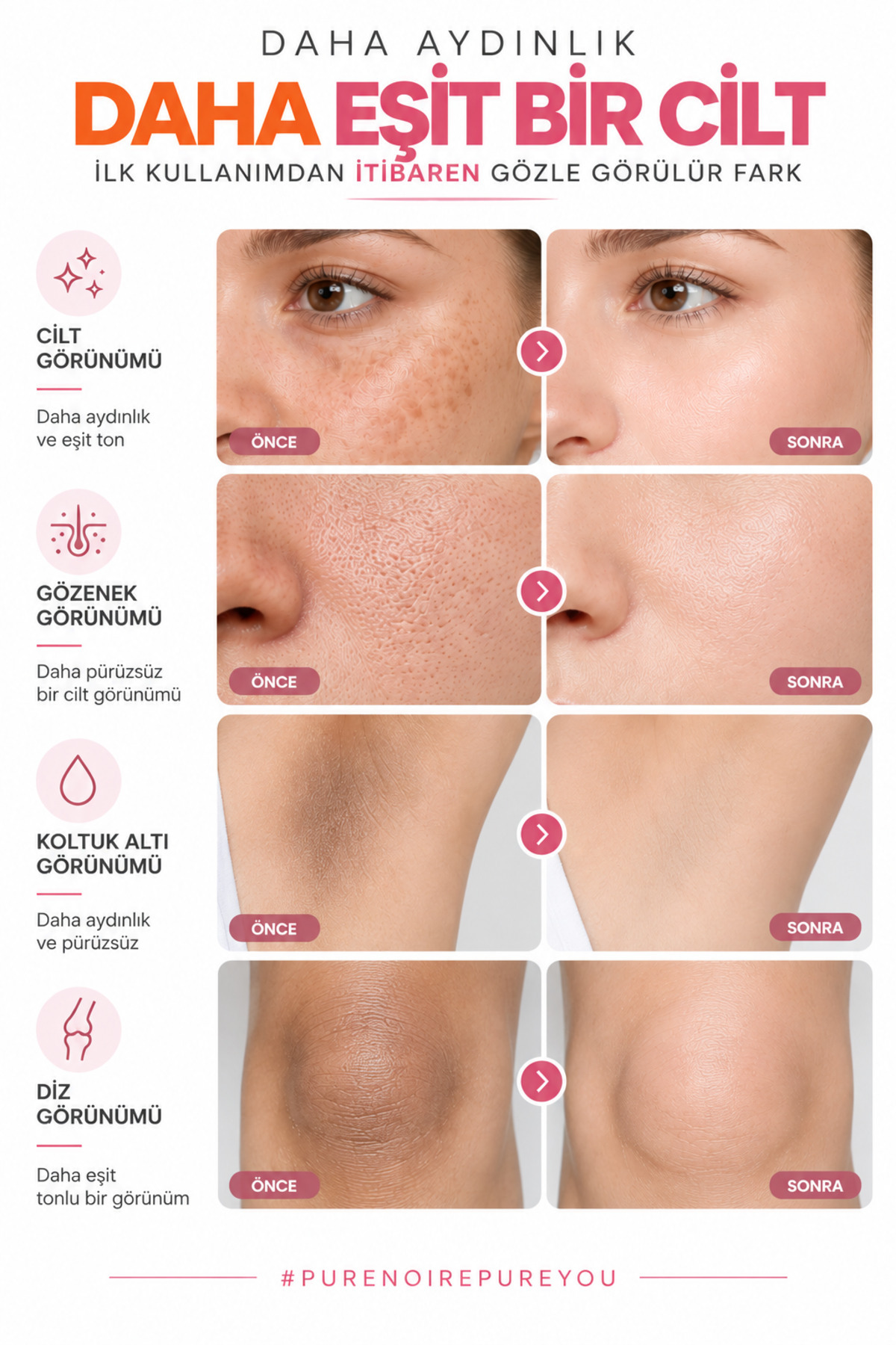 Aydınlatıcı Bakım Seti,Niacinamide,Ferulic Acid,Vitamin B5,Collagen,Kojic Acid — 216516 — تصویر 3 از 5