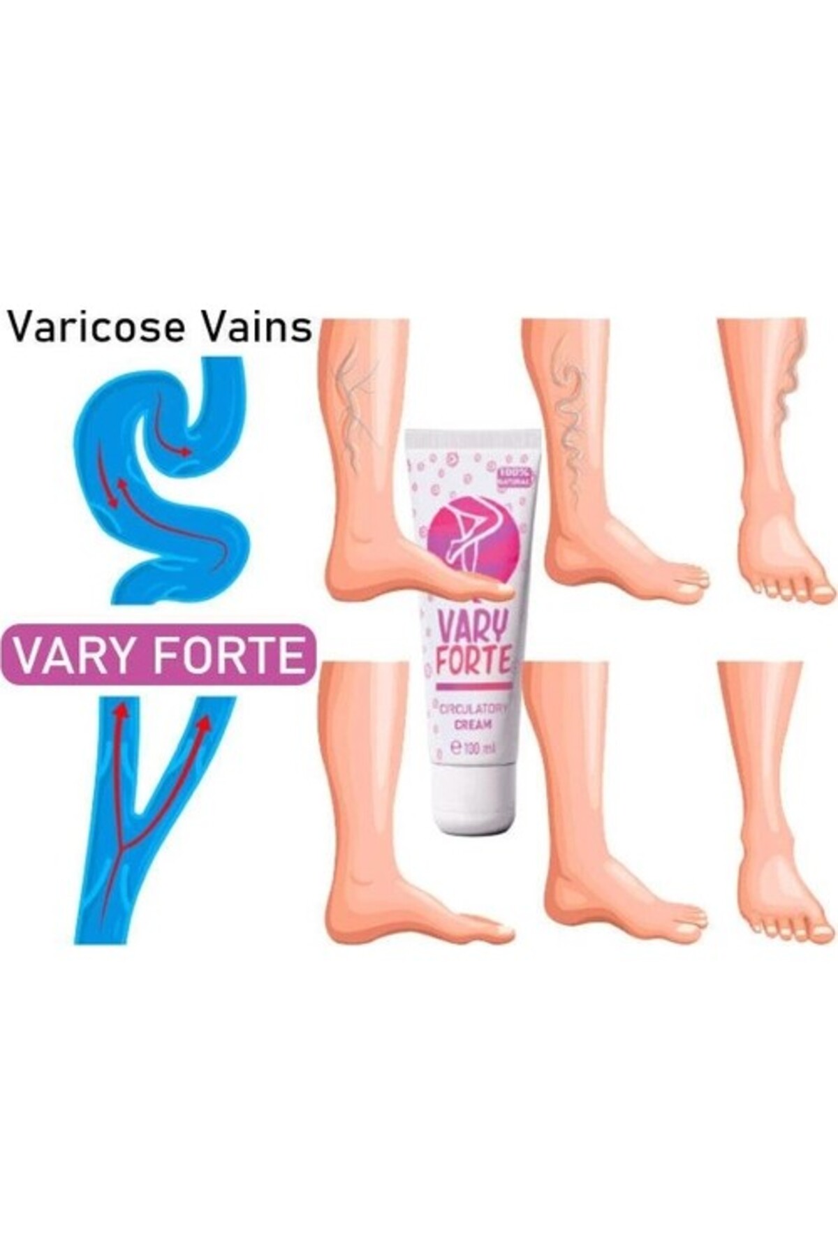 Varyforte Bacaklarınızdaki Varislerinize Karşıkremi Tüp 100 ml x 1 Adet — GU-EYF-20579-BLN — تصویر 4 از 4