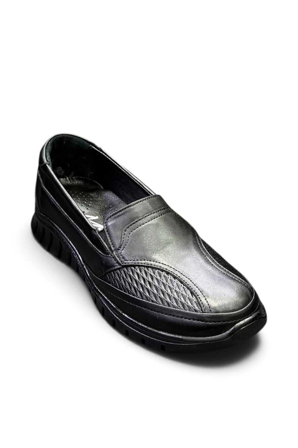 İYİSİNDEN SHOES Hakiki Deri Kadın Anne Ayakkabısı - Kemik Çıkıntısına Uygun - Ortopedik Taban Kaydırmaz Kauçuk Taban Rahat Kalıp görsel 2