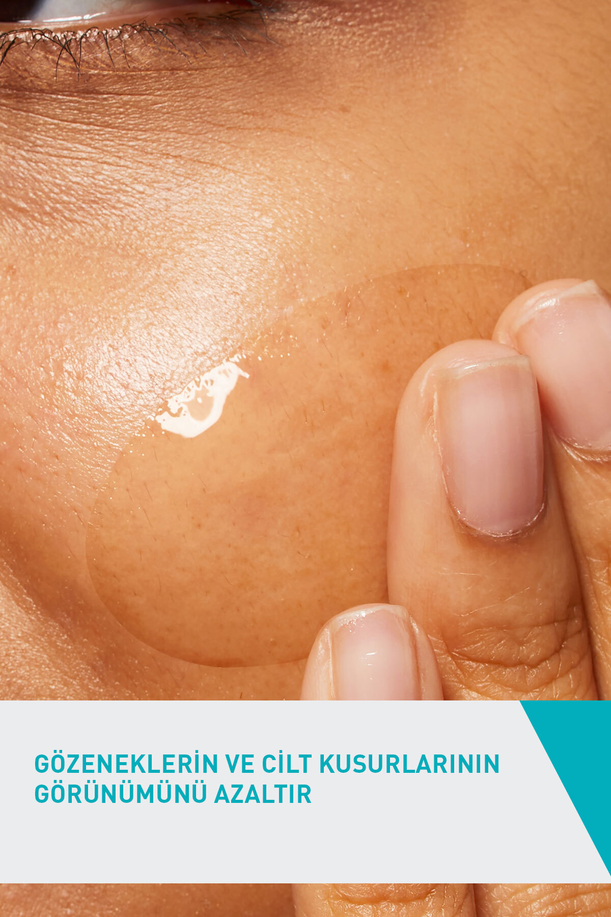 Yağlı ve Akneye Eğilimli Ciltlere Özel Cilt Bakım Seti: Yüz Temizleme Jeli 236ml&Yüz Bakım Jeli 40ml — 2031 — تصویر 8 از 8