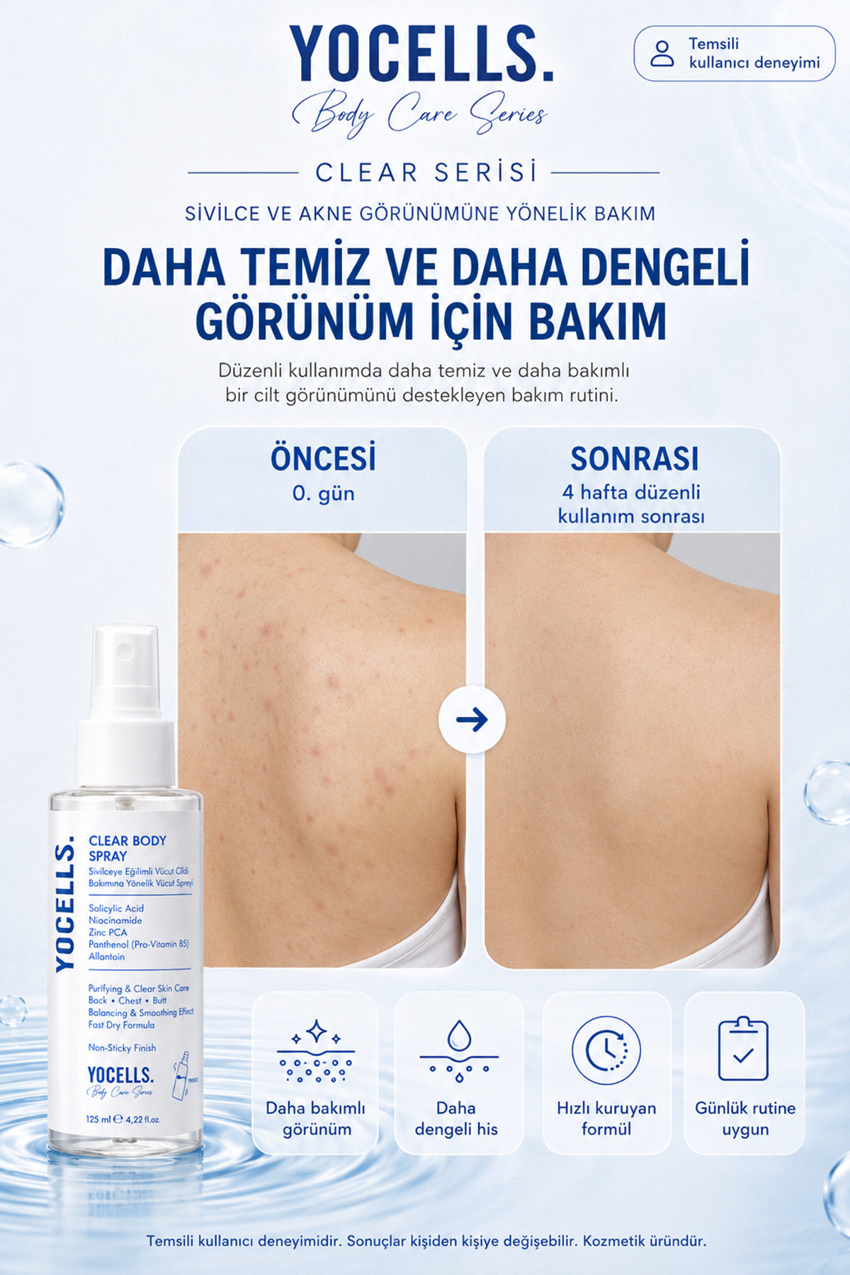 Sırt Göğüs Kalça ve Akne Görünümüne Yönelik Vücut Spreyi Salisilik Asit Niasinamid Zinc PCA 125 ml — VSS01 — تصویر 2 از 6