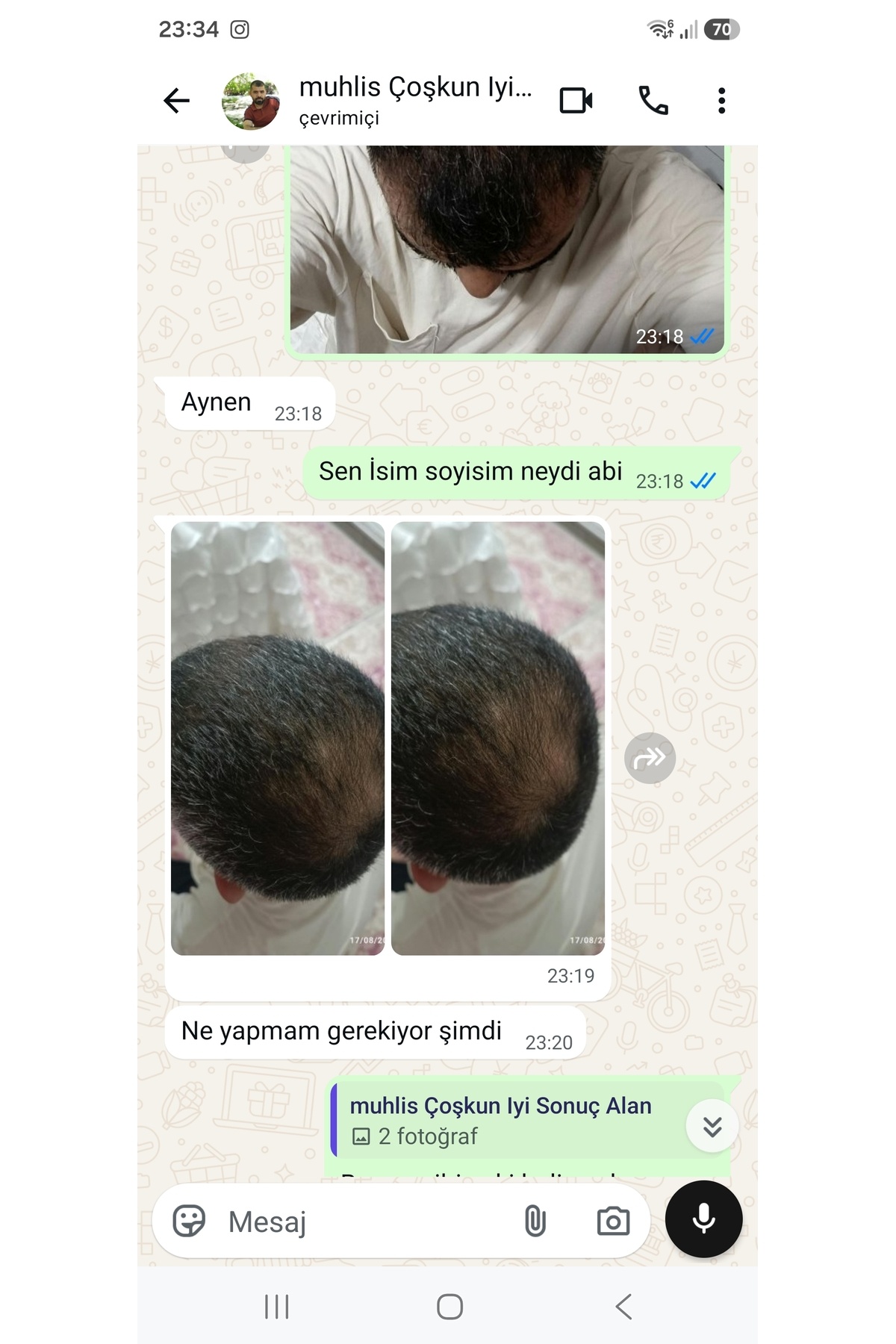 محلول رفع زردی مو — ۸۶۸۵۱۵۷۹۳۹۲۱۶ — تصویر 5 از 8