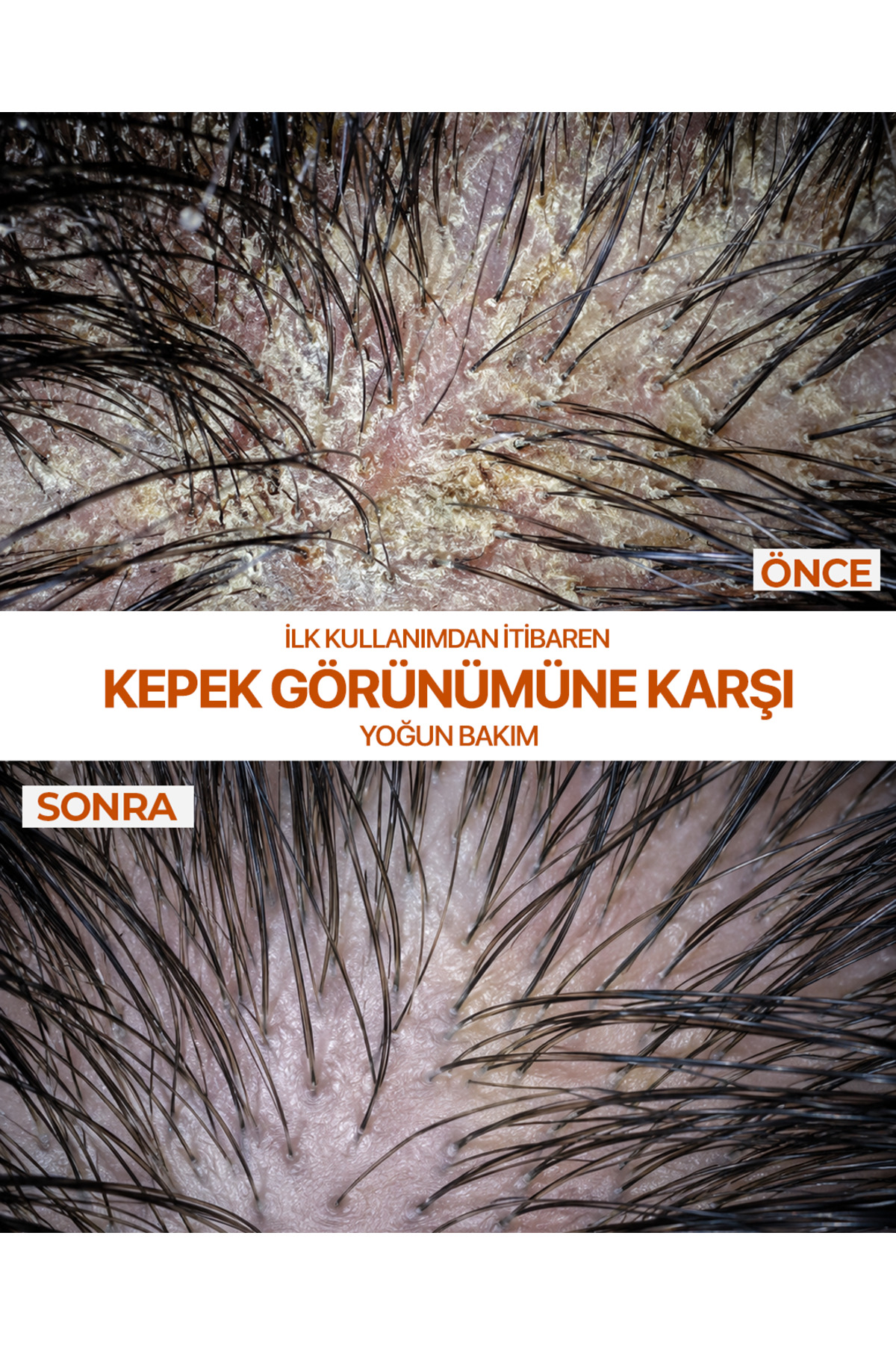 Clinical Series | Yatıştırıcı Kepek Karşıtı ve Egzama Eğilimli Saç Derisi İçin Yoğun Bakım Şampuanı – Selenium Sulfide %1 – 400 ml — EGZSMP01 — تصویر 4 از 6