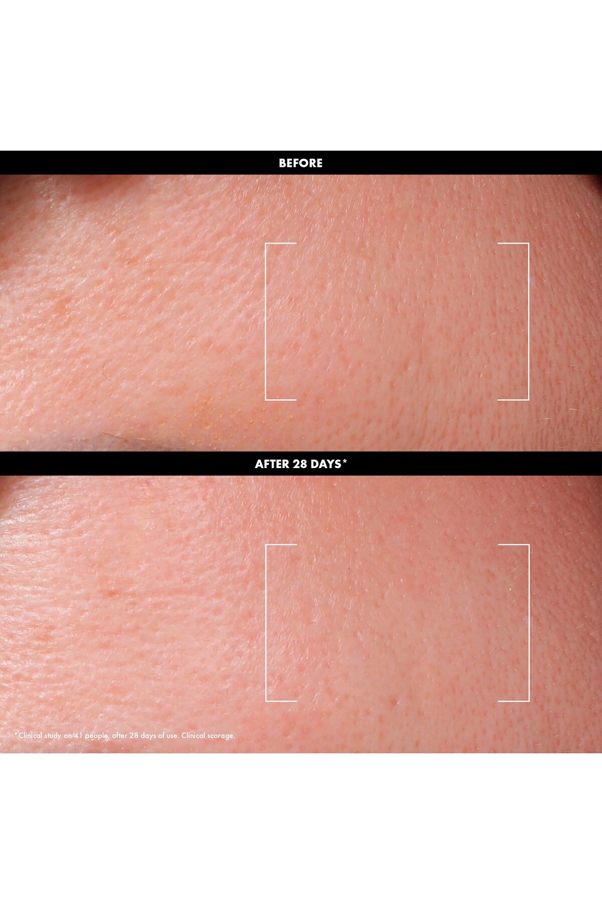 EXFOLIATE - %3 AHA + %2 C vitamini içeren günlük peeling losyonu - 200 ml — HLC-SC-P1000211542 — تصویر 3 از 6