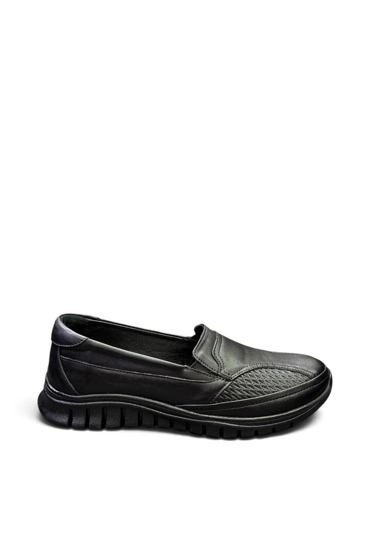 İYİSİNDEN SHOES Hakiki Deri Kadın Anne Ayakkabısı - Kemik Çıkıntısına Uygun - Ortopedik Taban Kaydırmaz Kauçuk Taban Rahat Kalıp görsel 4