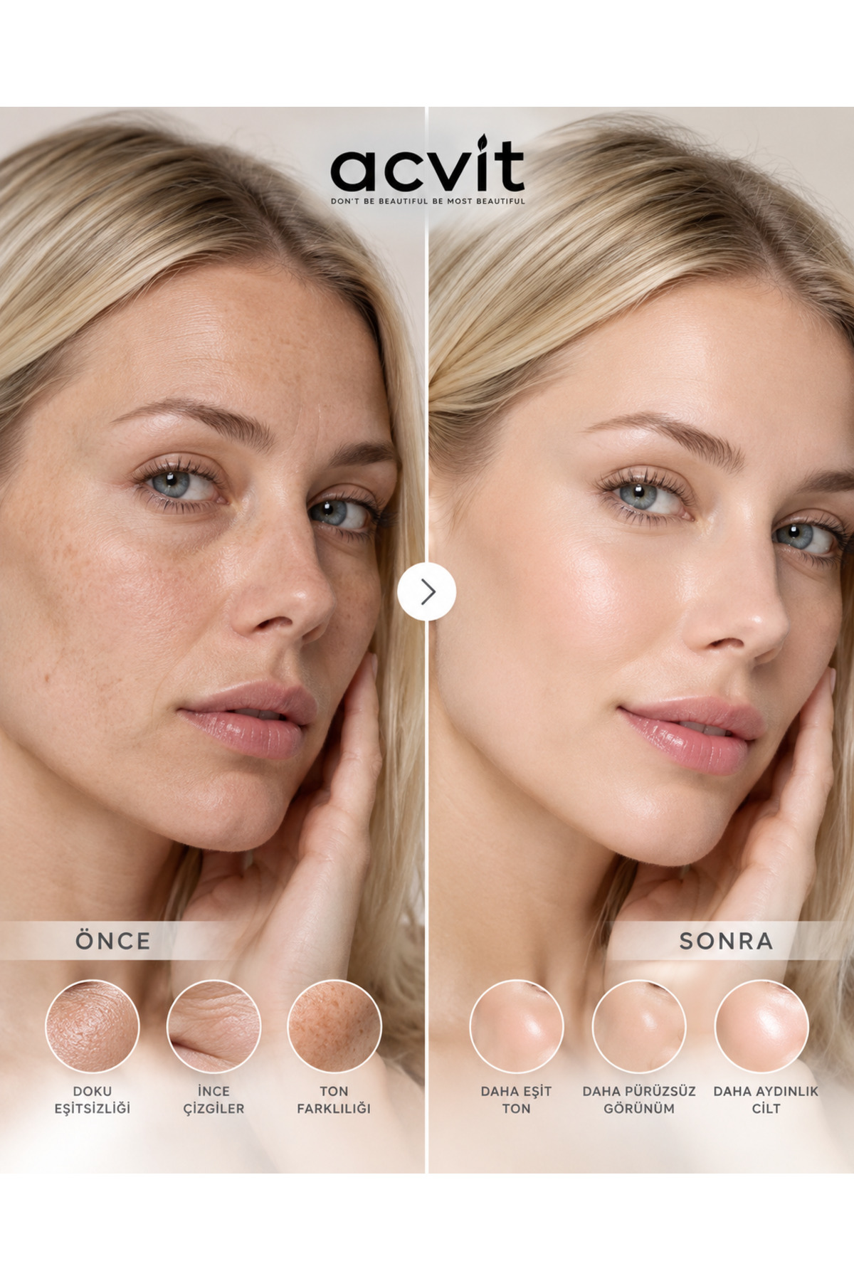 Retinol Alpha Arbutin Serum 30 ML |Kırışıklık Karşıtı ve Cilt Yenileyici Bakım — RAAS082024 — تصویر 4 از 9