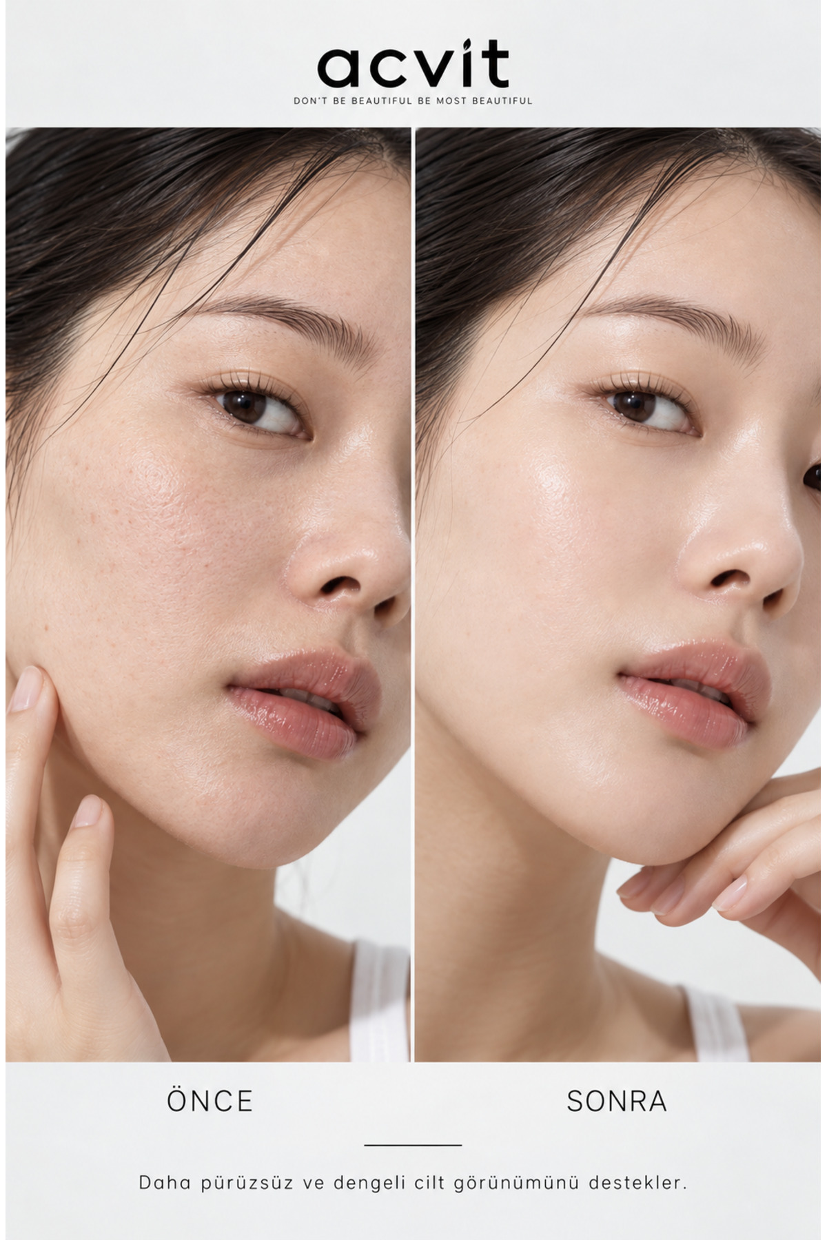Acvit Atopik ve Hassas Ciltler İçin Jel Peeling 100 ML | Arındırıcı ve Cilt Yenileyici Bakım — atopil100 — تصویر 6 از 7