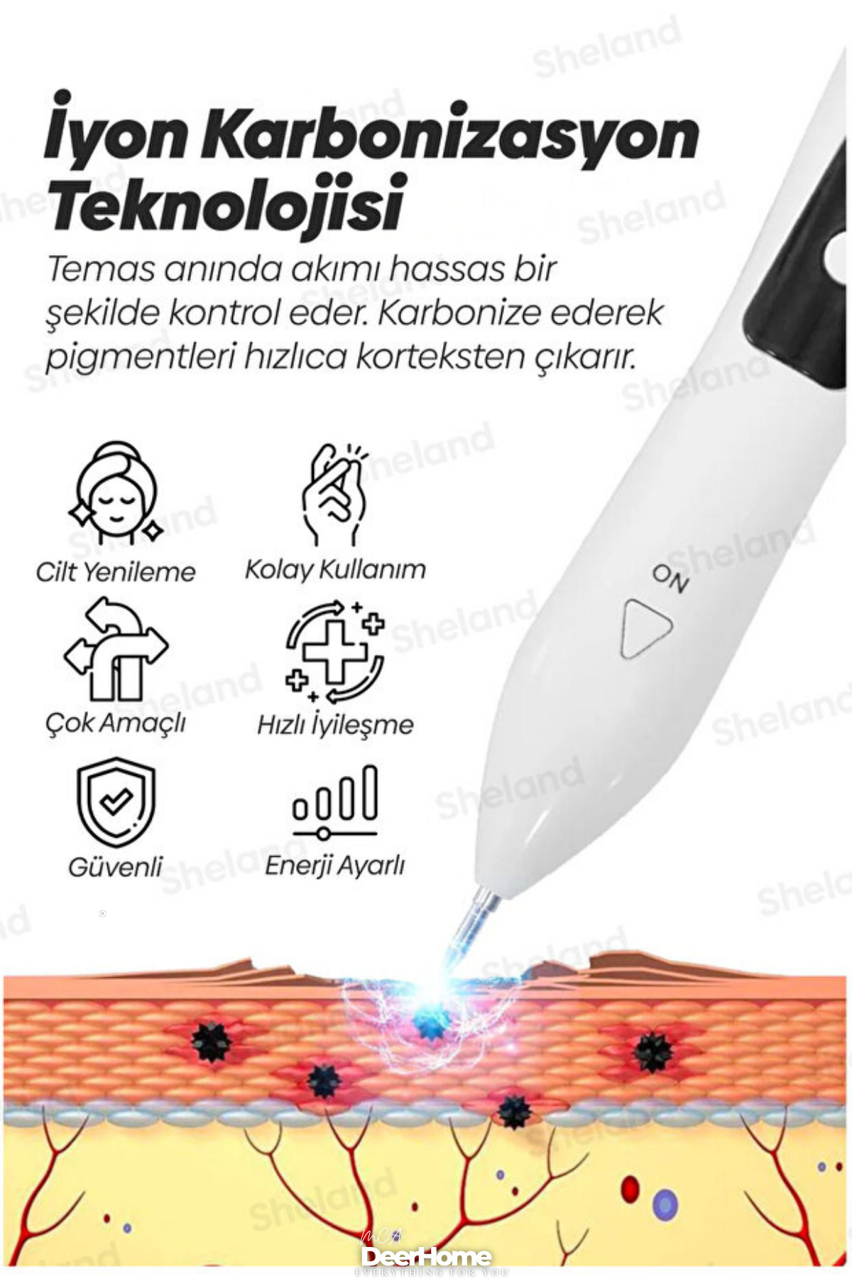 UV Işıklı Profesiyonel Plazma Laser Pen Mole Akne, , Ben, Dövme,çatlak Leke Silme Cilt Bakım — رنگارنگ MCAPLZMPEN — تصویر 4 از 7