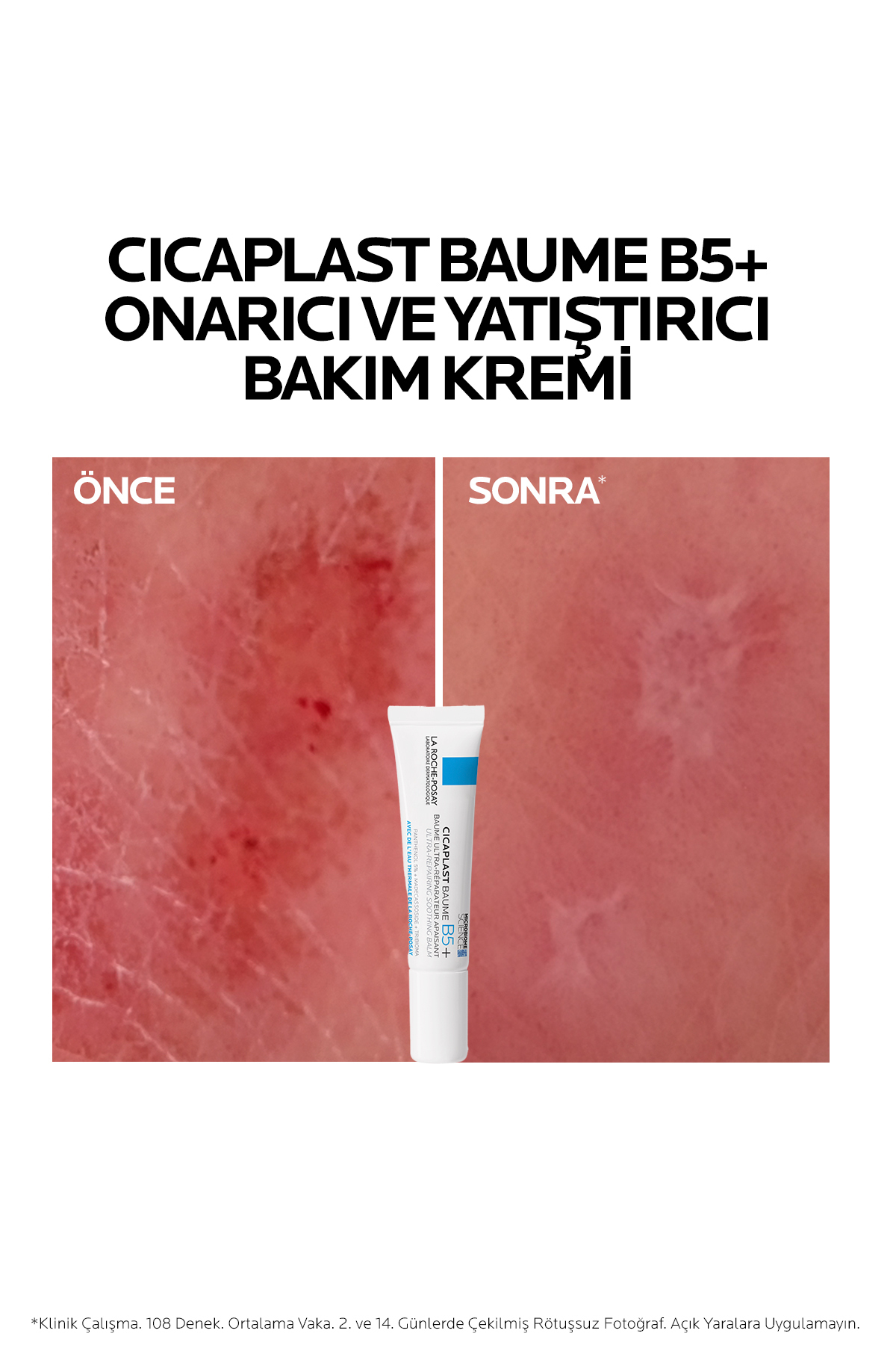 کرم مراقبت صورت و بدن سی کا پلاس بالم B5+ برای پوست‌های تحریک شده، تسکین‌دهنده و ترمیم‌کننده باریر 15 میلی‌لیتر