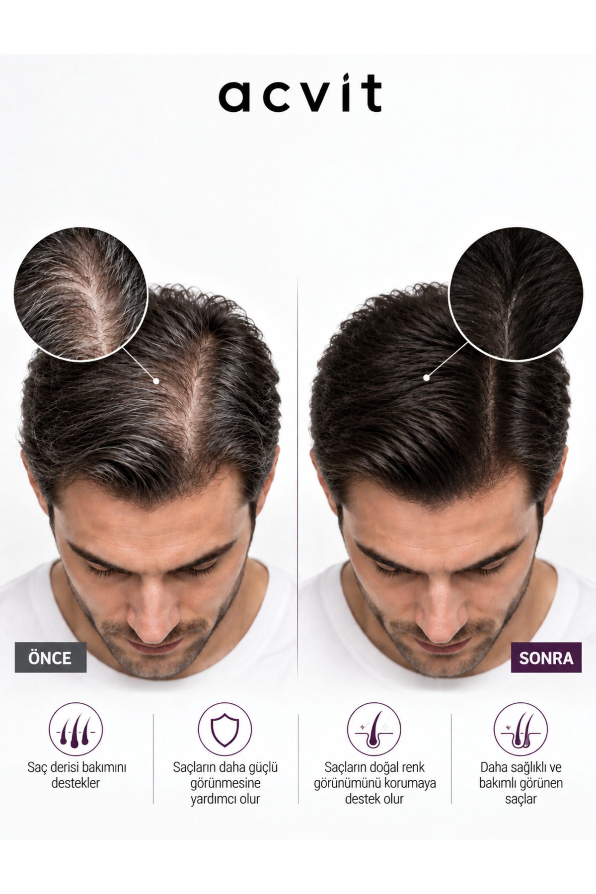 ACVİT Growth Duo – Güçlü Saç Bakım Seti — growthduo — تصویر 6 از 6