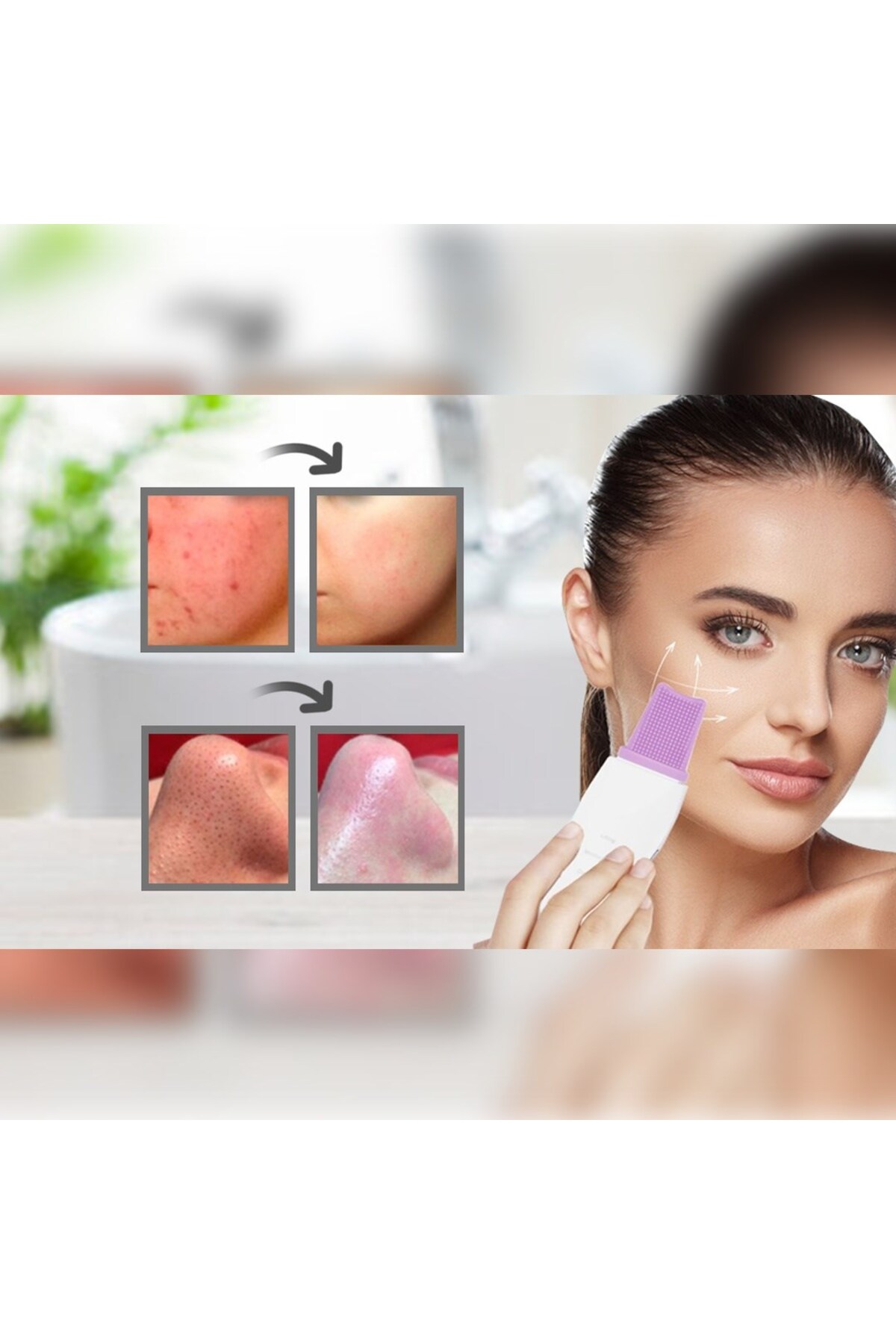 کاردک اولتراسونیک ۴ تکه مخصوص جوش‌های سرسیاه و قابل شارژ، پاک‌کننده پوست — ULTRASONIC-BLACKHEAD-A-4ADT — تصویر 3 از 3